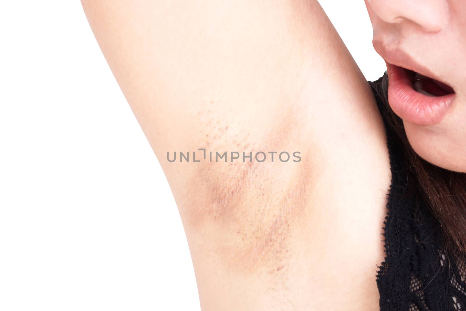 Women problem black armpit on white background for skin care and beauty concept