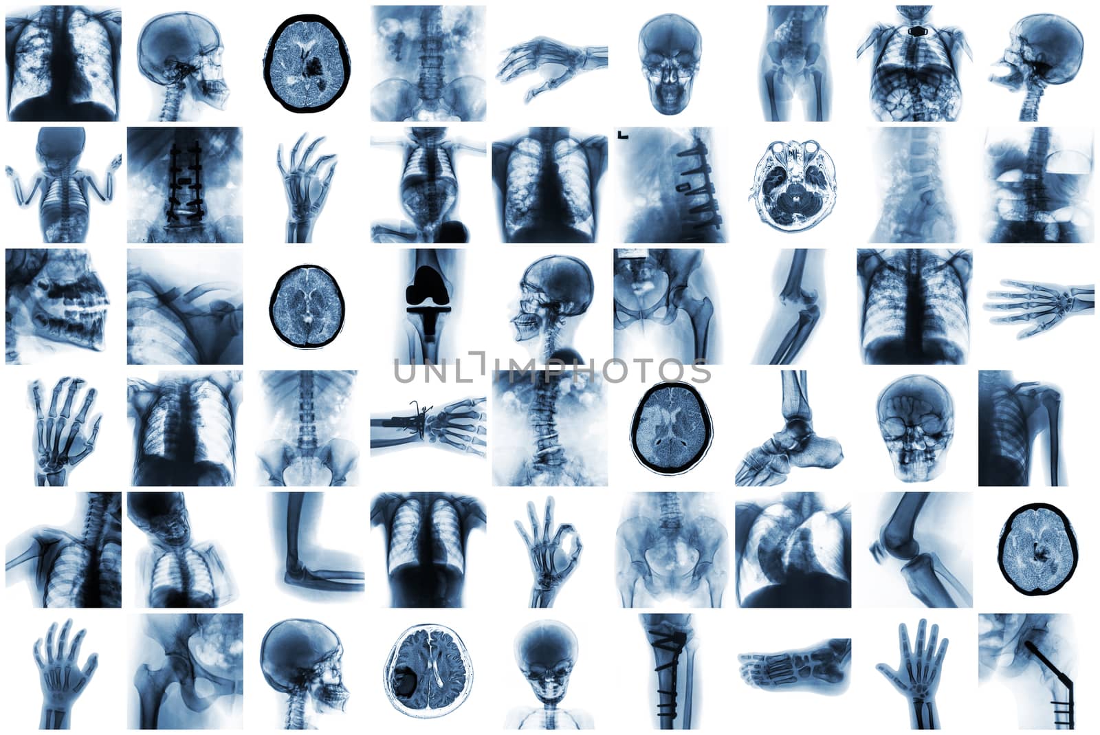 X-ray multiple part of human and many medical condition and disease .