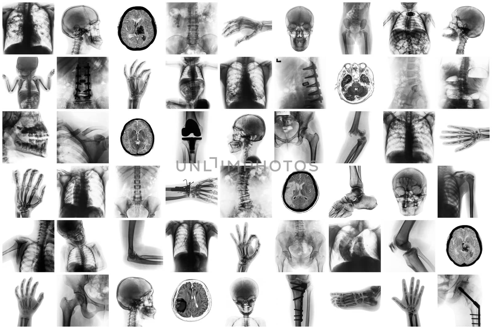 X-ray multiple part of human and many medical condition and disease by stockdevil