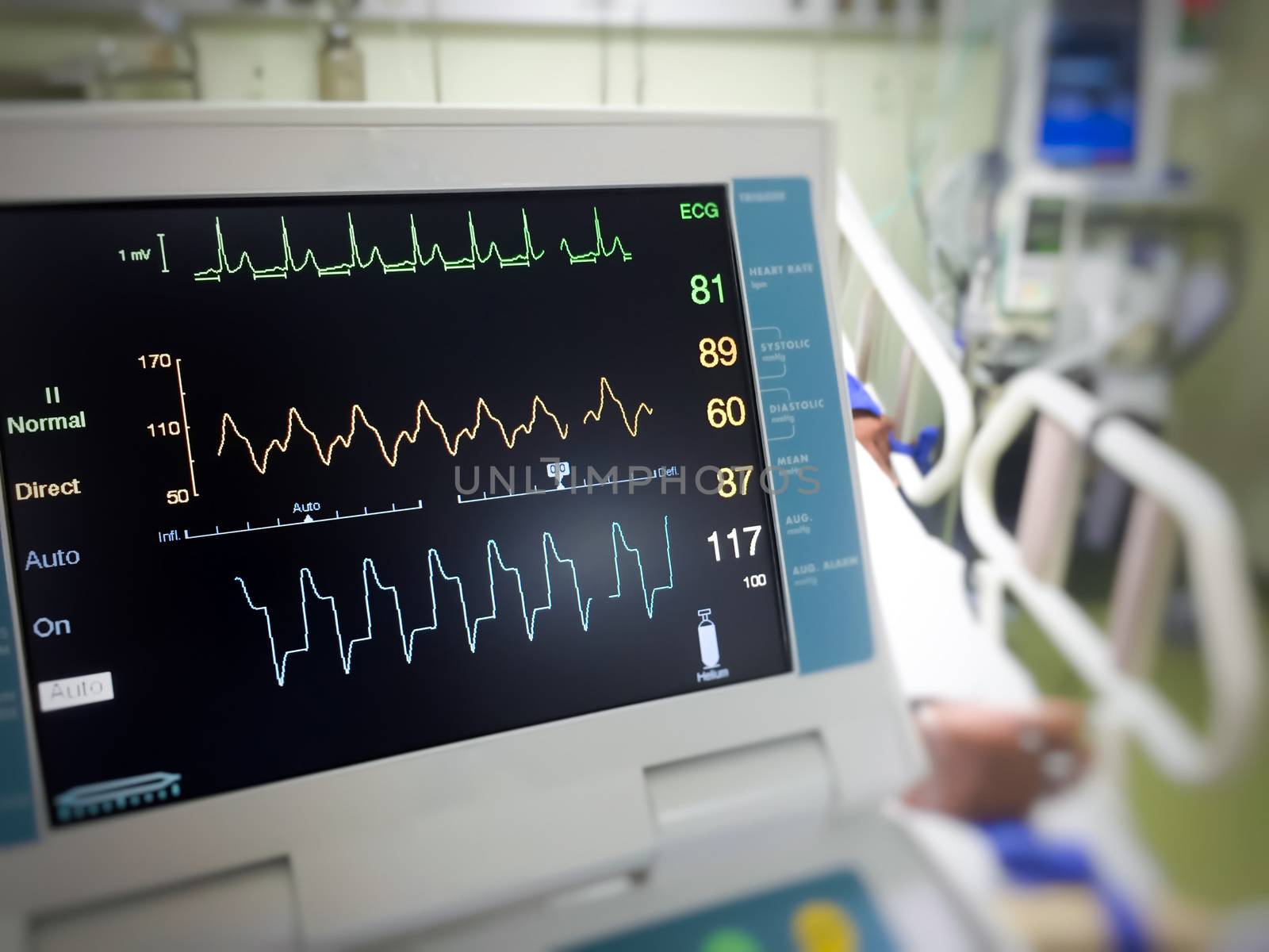 Close up EKG monitor in icu room