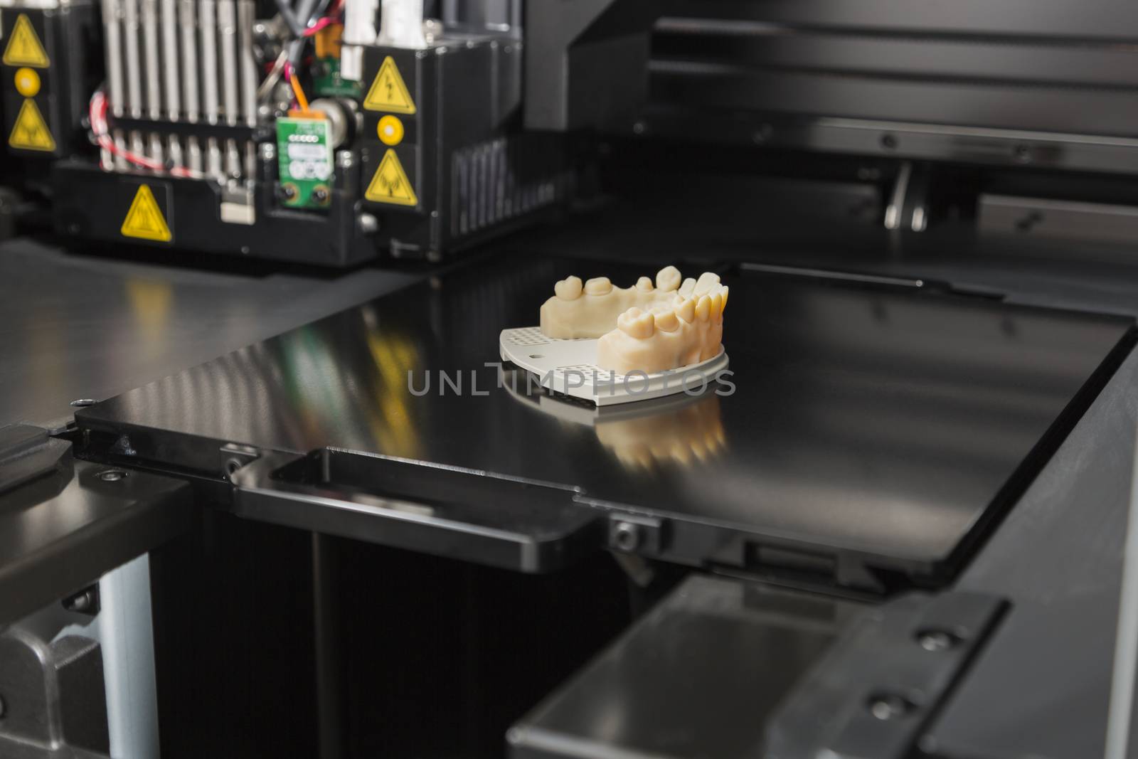 3D Printer With Finished 3D Printed Dental Implant Bridge by Feverpitched