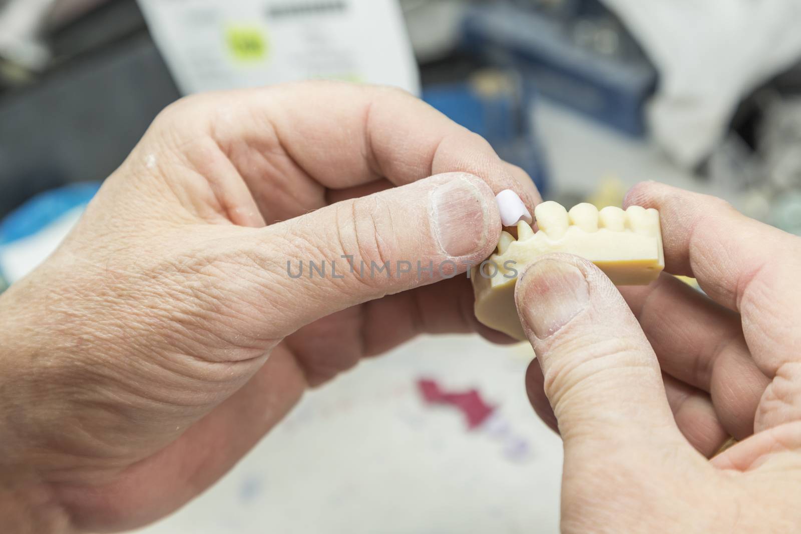 Male Dental Technician Working On A 3D Printed Mold For Tooth Implants In The Lab.