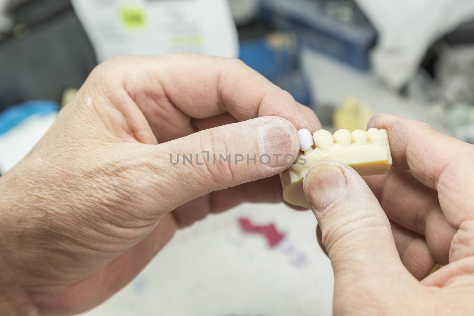 Male Dental Technician Working On A 3D Printed Mold For Tooth Implants In The Lab.