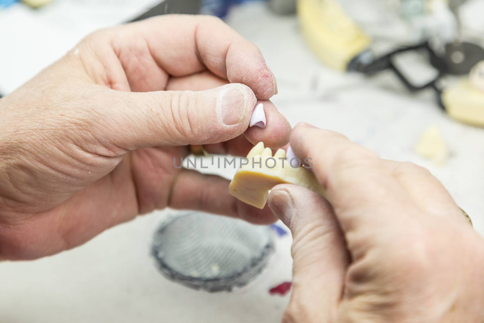 Male Dental Technician Working On A 3D Printed Mold For Tooth Implants In The Lab.