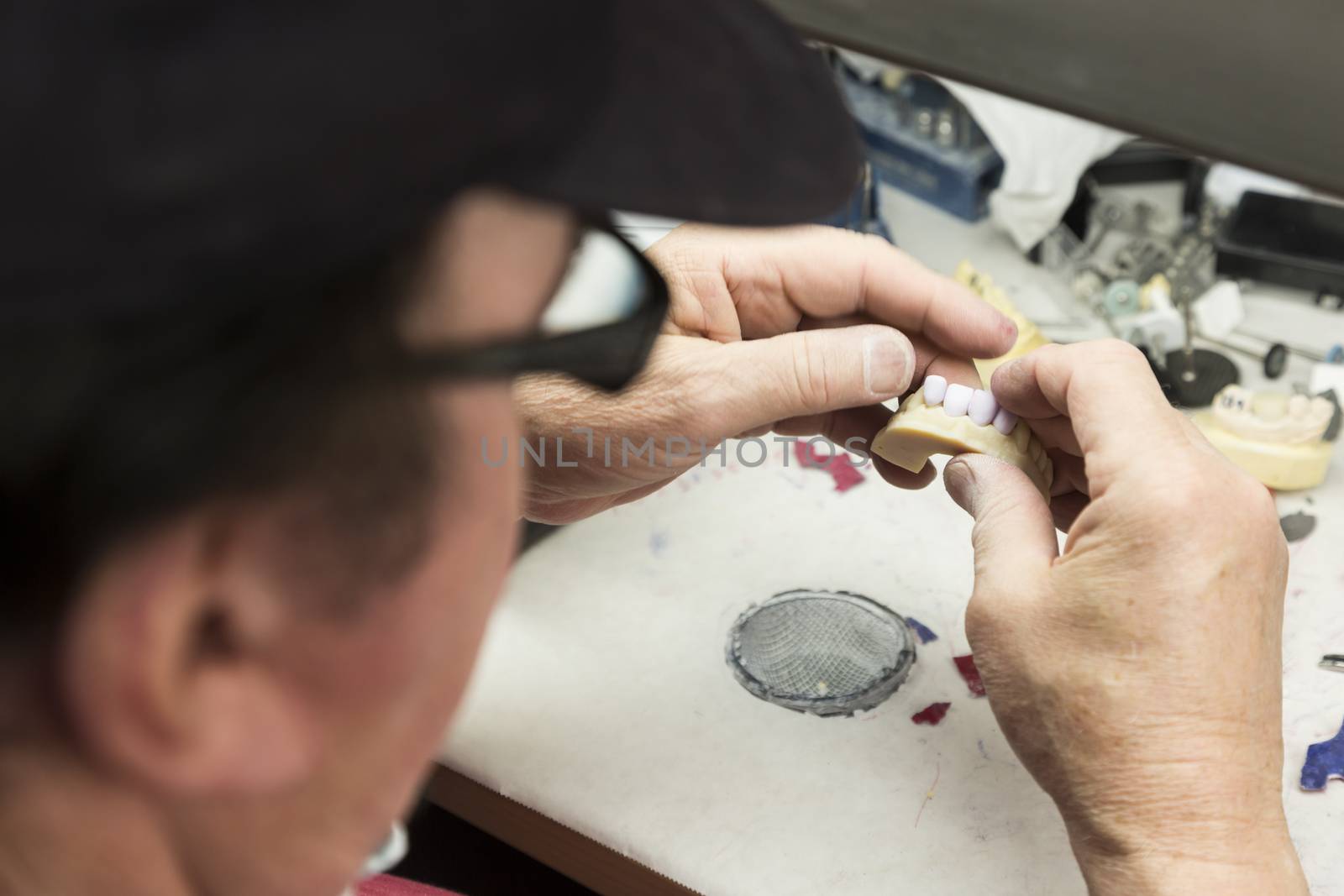 Dental Technician Working On 3D Printed Mold For Tooth Implants by Feverpitched