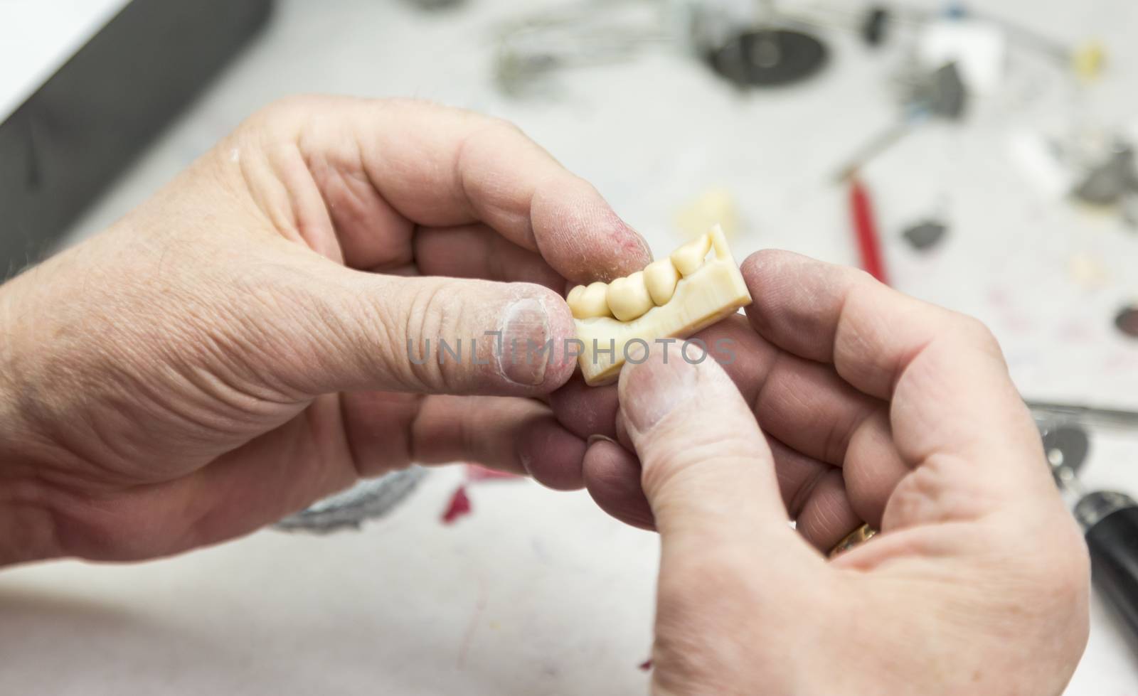 Male Dental Technician Working On A 3D Printed Mold For Tooth Implants In The Lab.