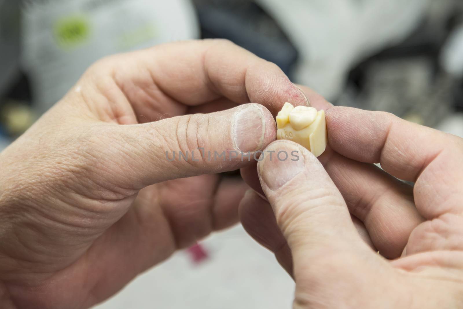 Dental Technician Working On 3D Printed Mold For Tooth Implants by Feverpitched