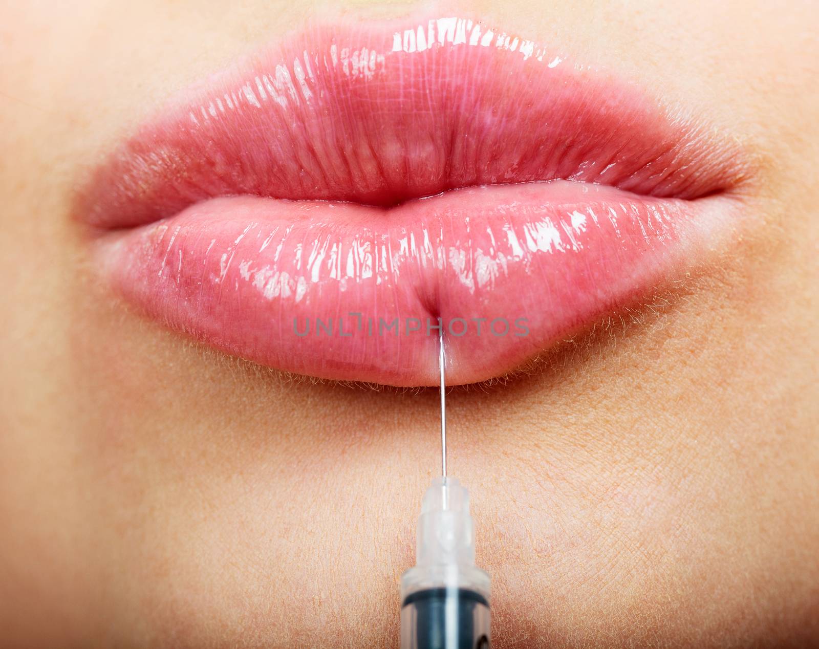Closeup shot of beautiful female lips and syringe with filler