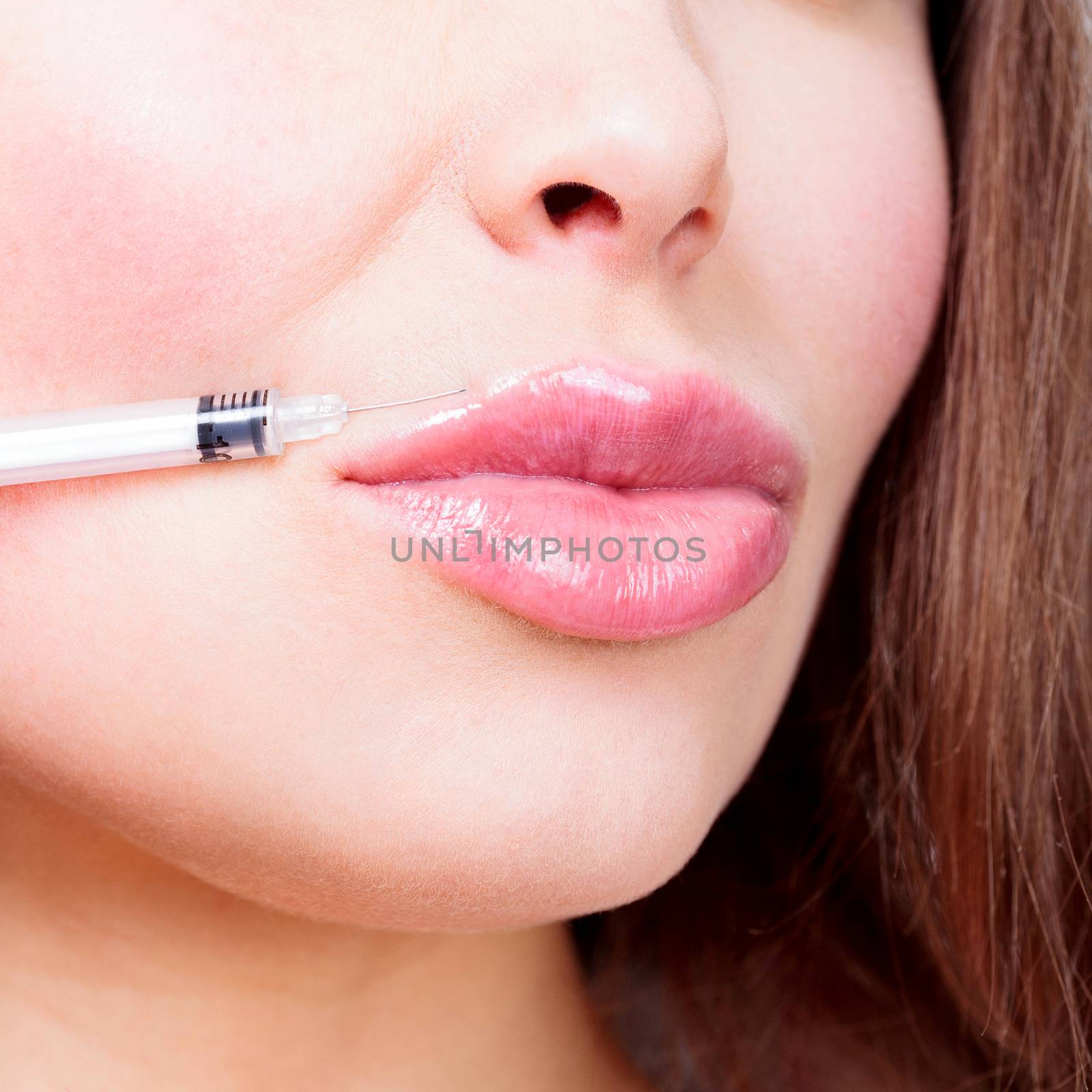 Closeup shot of beautiful female lips and syringe with filler. by Nobilior
