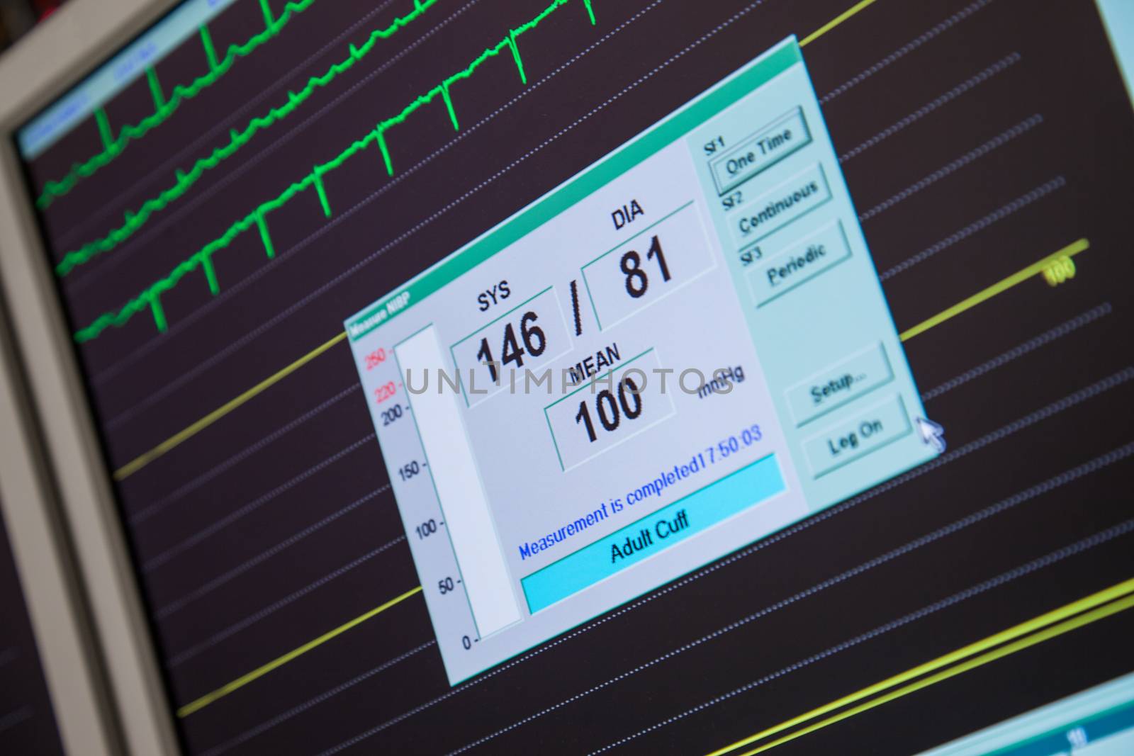 A close-up of a monitor with blood pressure and heart rate displayed.