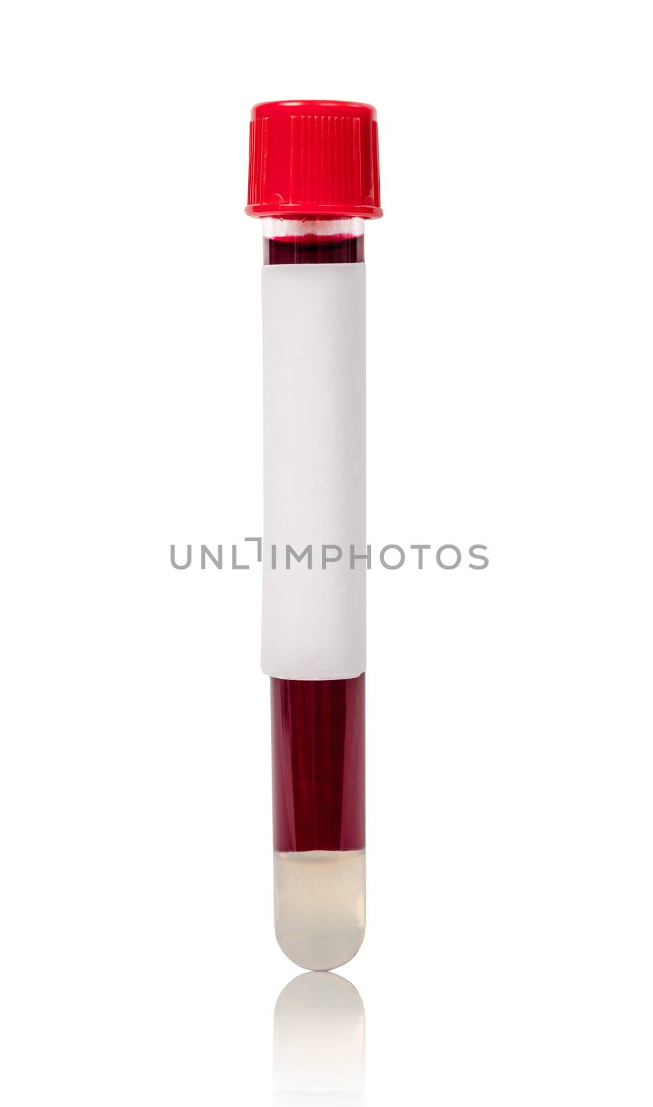 Red vacuum blood tube test with sample blood. by Gamjai