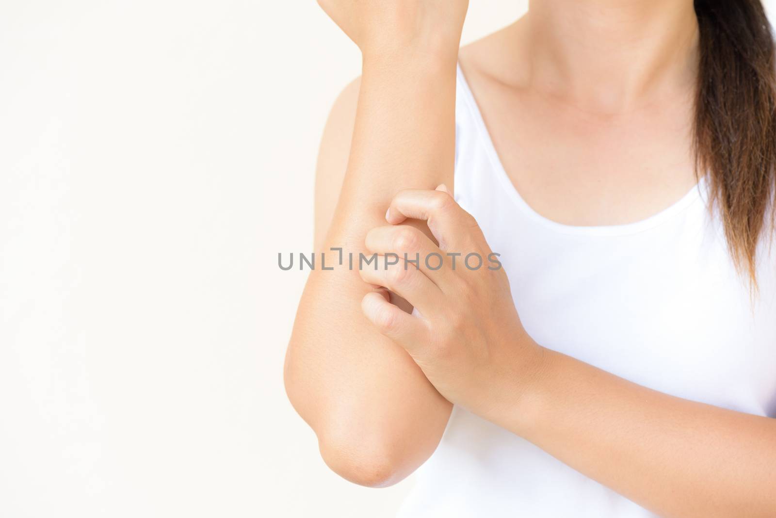 Close up woman arm scratch the itch by hand at home. Healthcare  by spukkato