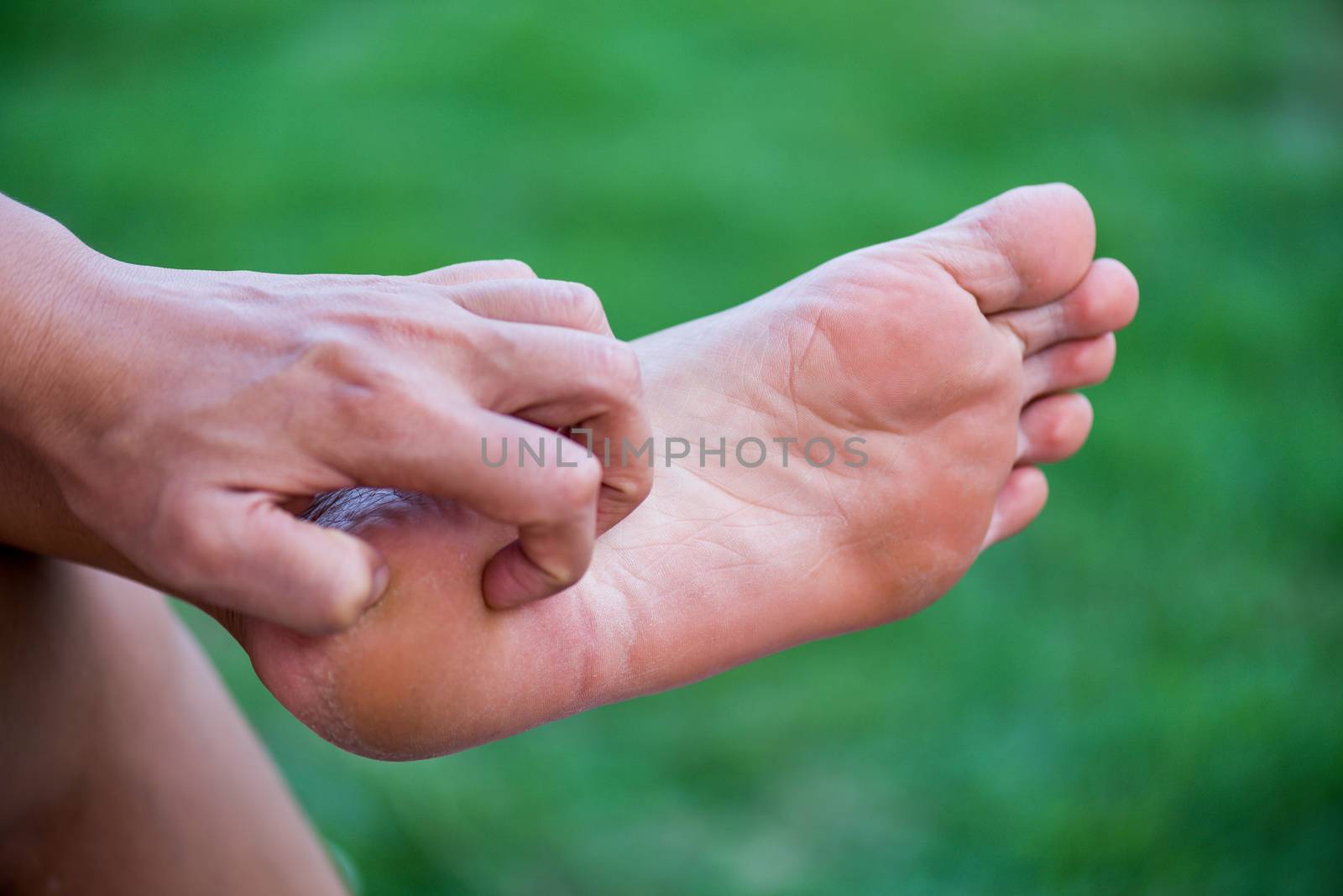 Close up woman hand scratch the itch by hand at home. Healthcare by spukkato