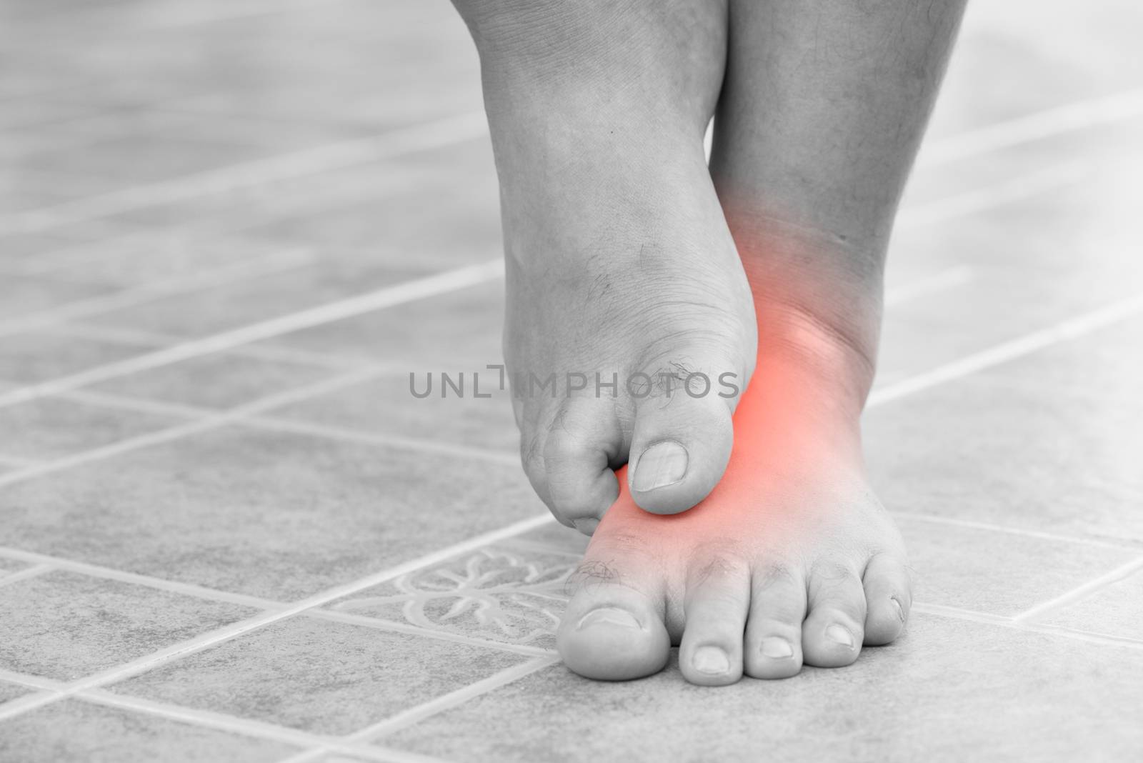 Close up man scratch the itchy feet by other foot at home. Healthcare and medical concept.
