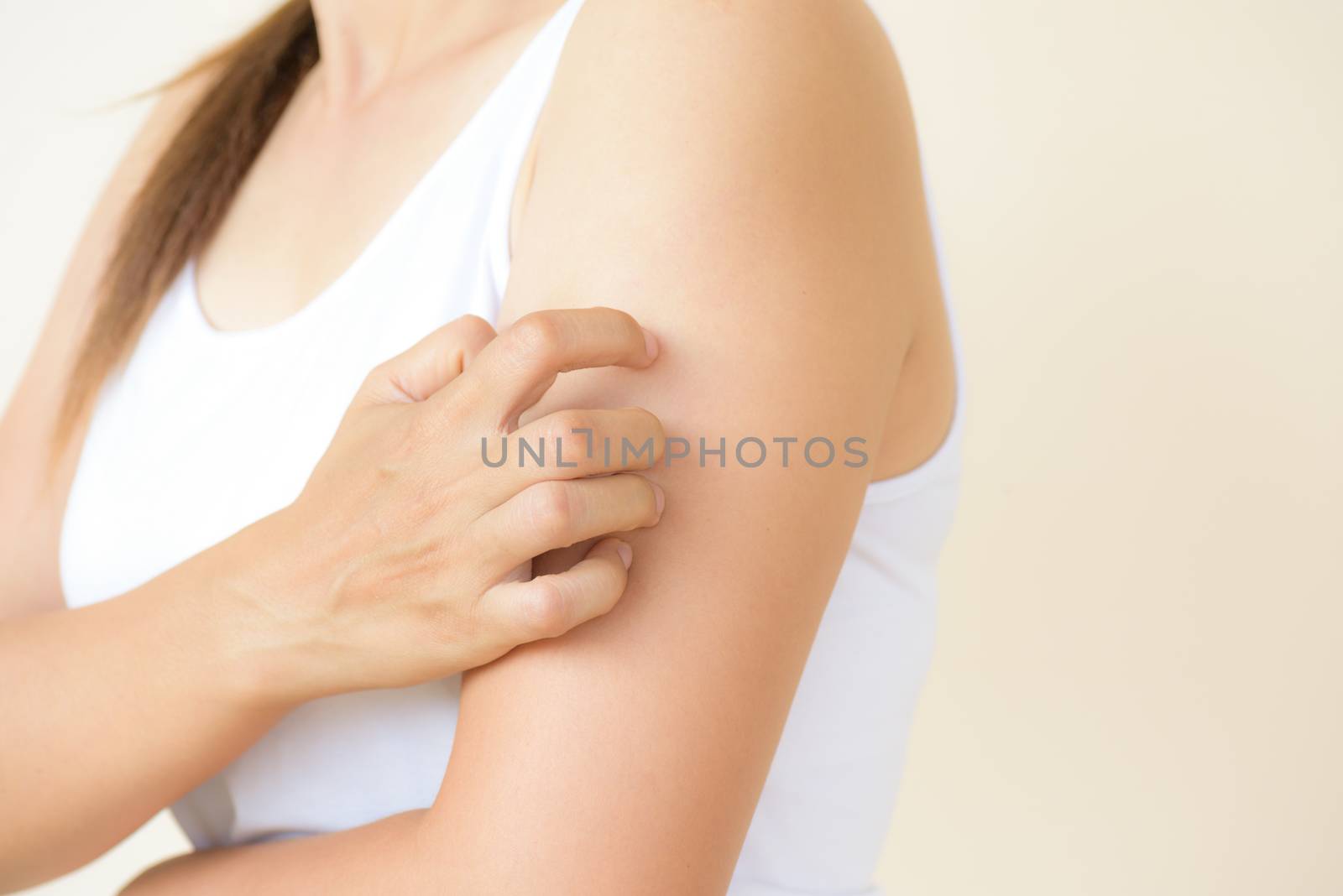 Close up woman arm scratch the itch by hand at home. Healthcare  by spukkato