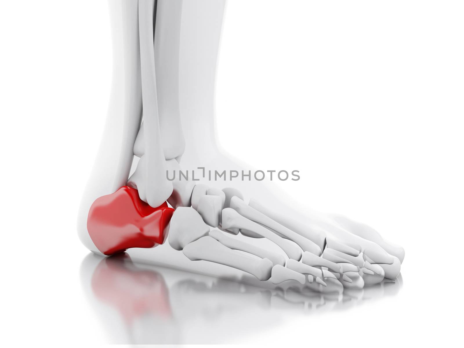 3d illustration. Painful ankle on white background. Medicine concept.