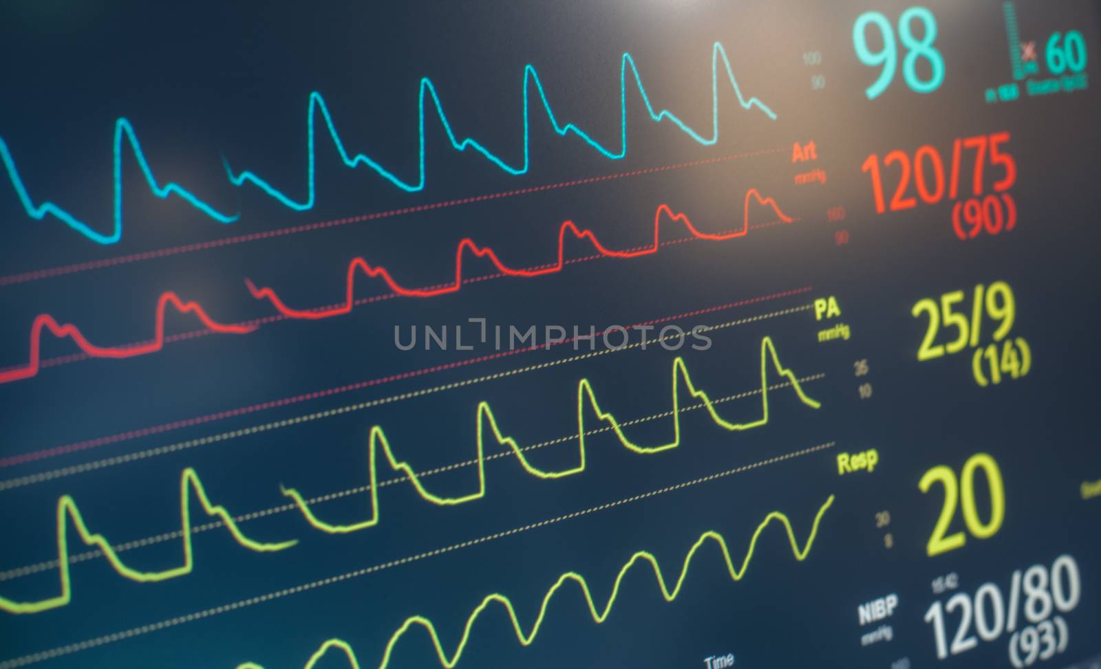 A hospital monitor with heart rate, pulse and respiratory data.