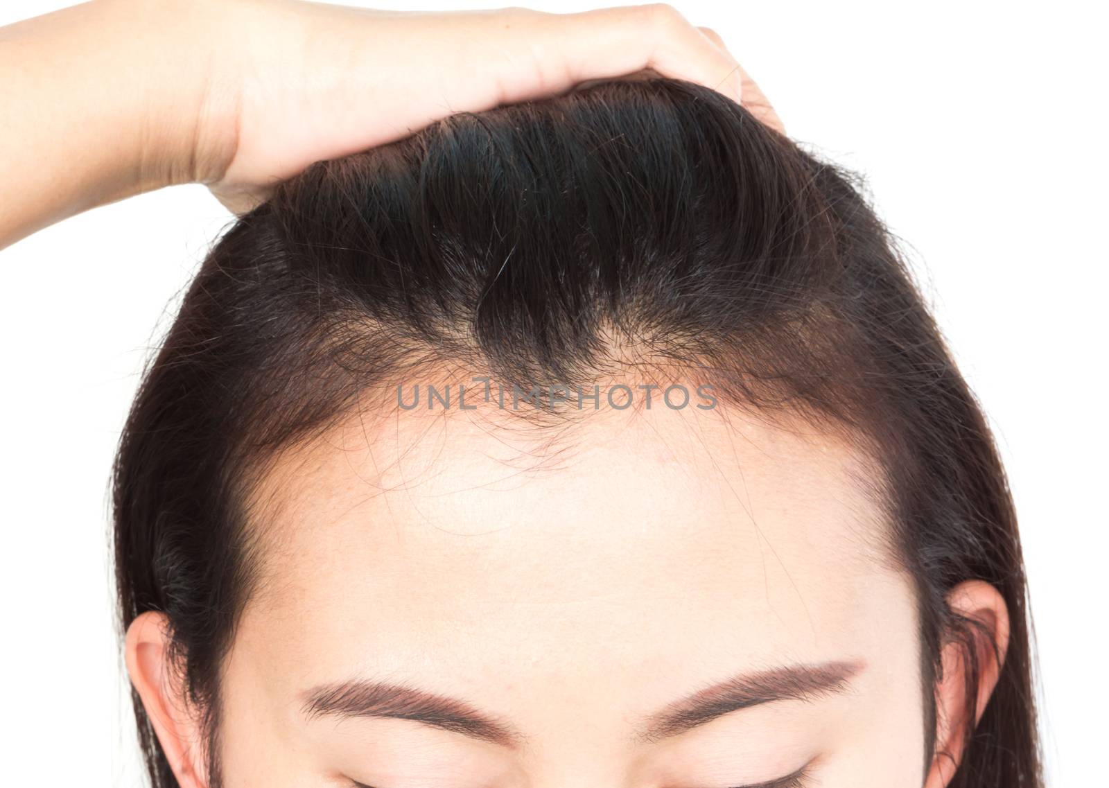 Woman serious hair loss problem for health care shampoo and beauty product concept