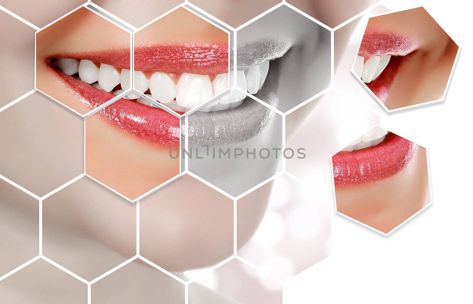 Picture of woman's smile against an abstract background with blurred lights, dental care concept