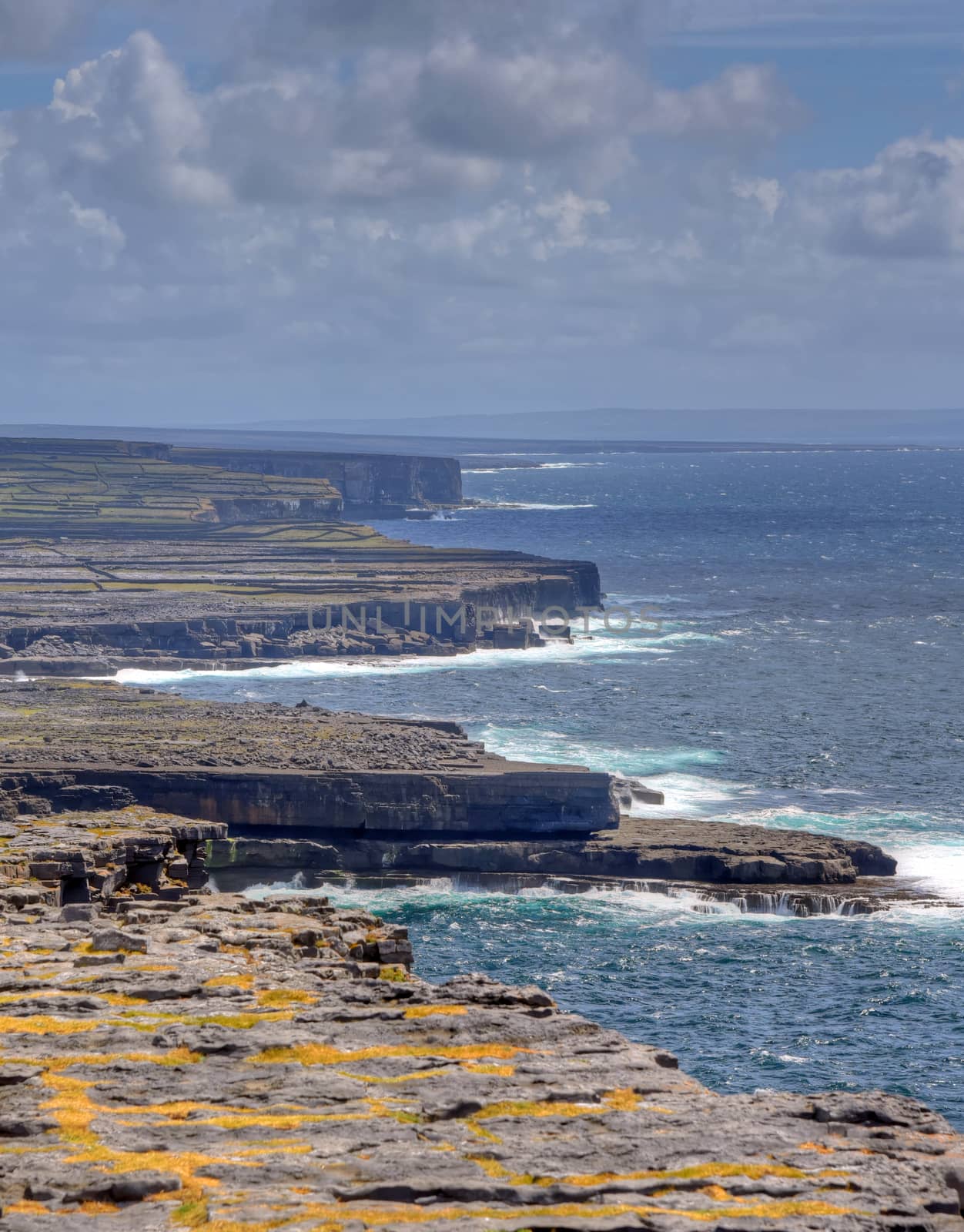 Aran Islands, Ireland by jbyard22