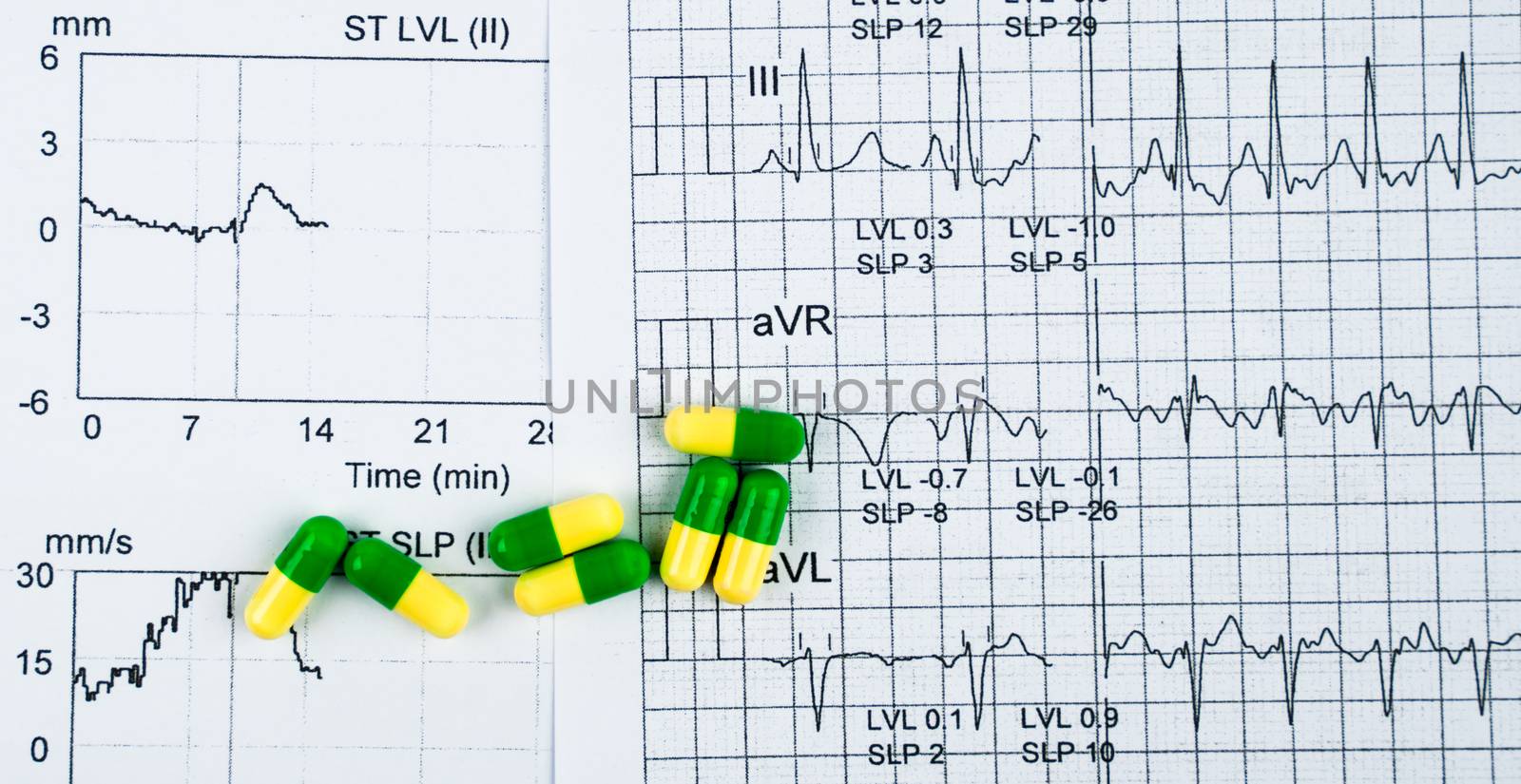 EKG or ECG (Electrocardiogram) graph report paper. EST ( Exercise Stress Test ) result and green-yellow capsule pills. Package promotion for heart check up in senior or elderly people concept. by Fahroni