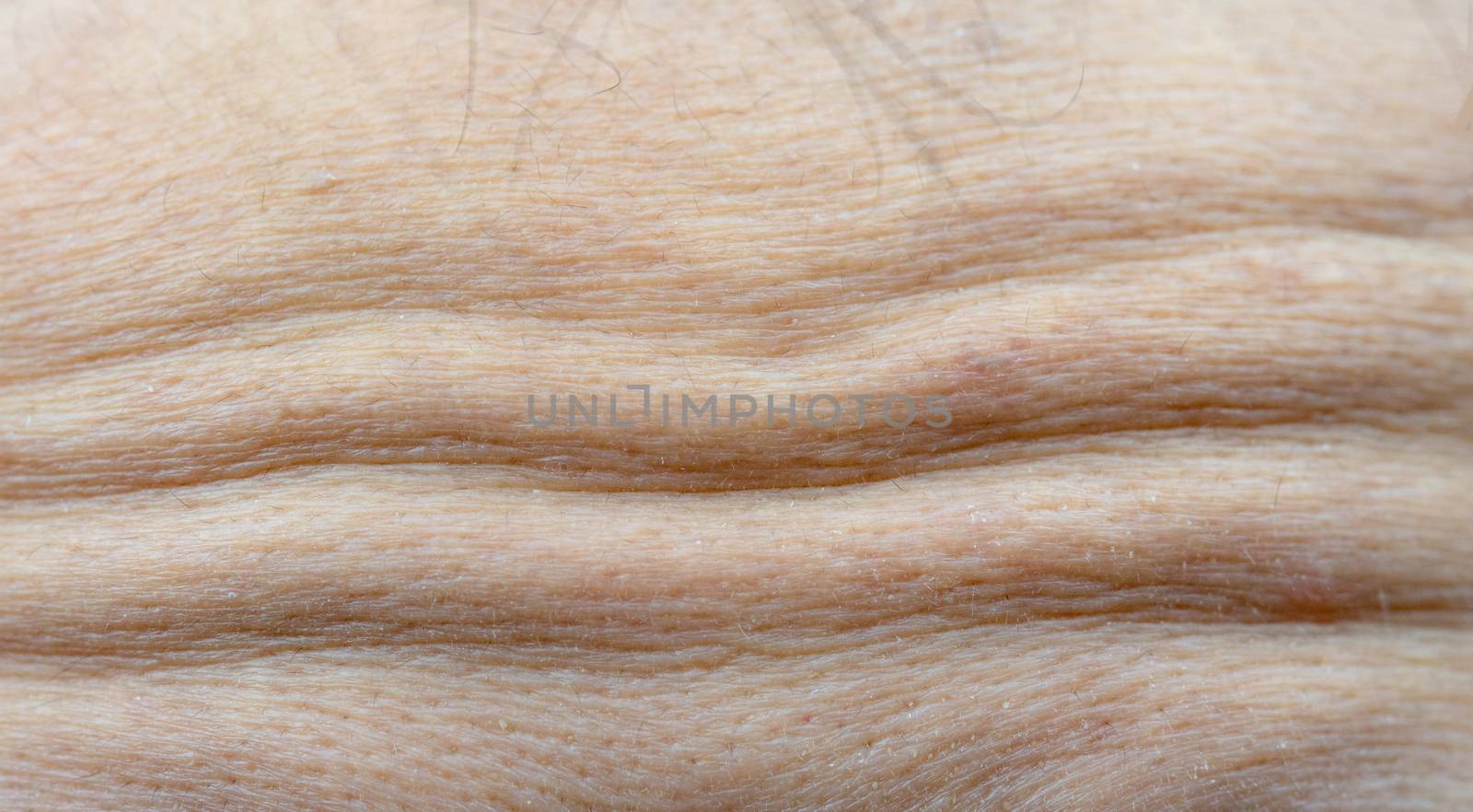 Macro shot detail of forehead wrinkles from emotional expression. Collagen and botox face injections concept. Dry forehead of face skin of menopause woman by Fahroni
