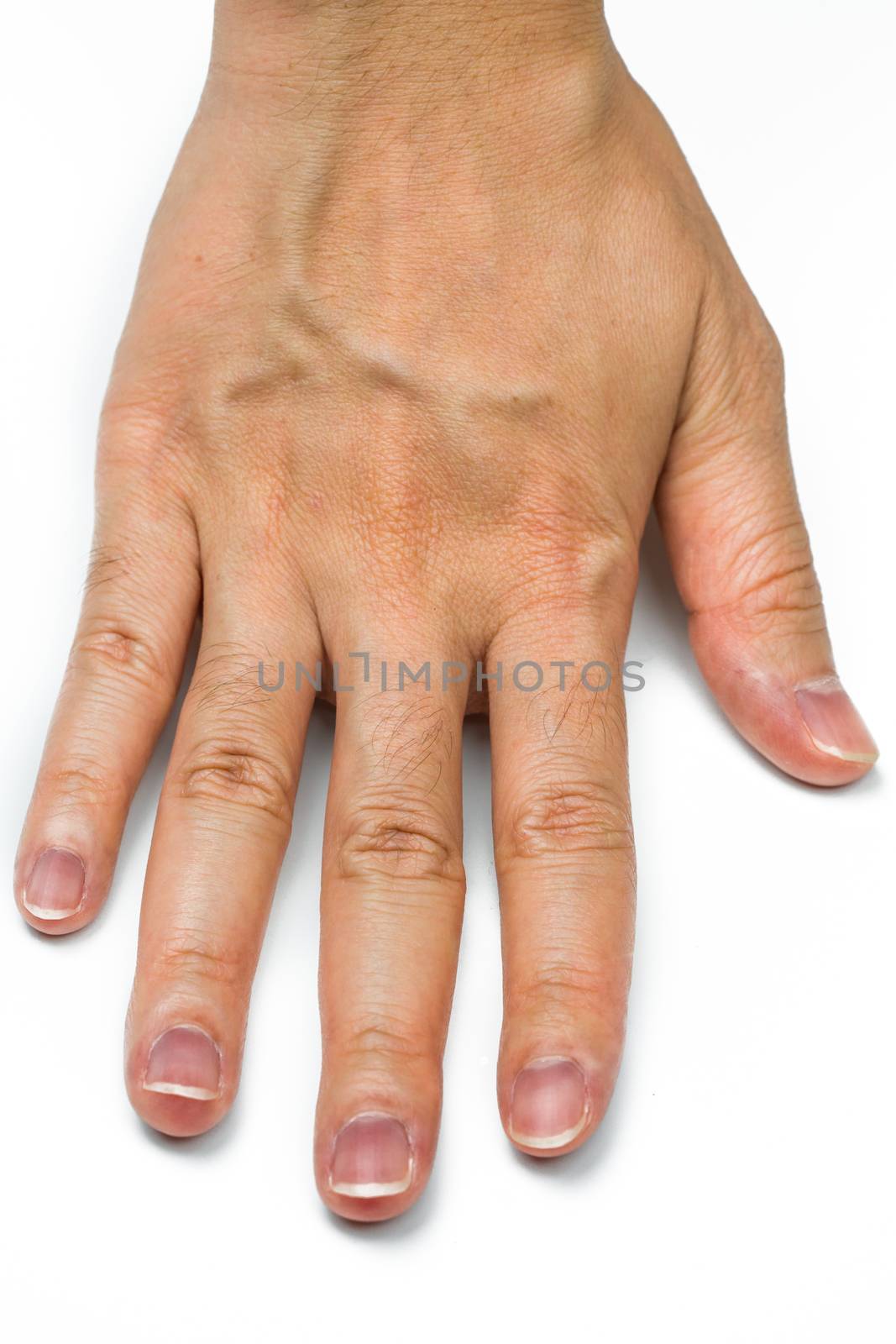 Woman hand with blood veins isolated on white background. Finger with mid-digital hair is dominant gene. Back of hand skin with dry and wrinkle in adult woman need spa or paraffin wax treatment. by Fahroni