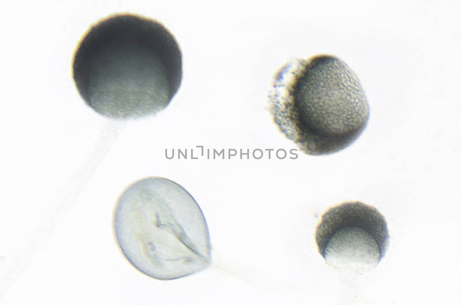 Microscope photography of Rhizopus by HERRAEZ