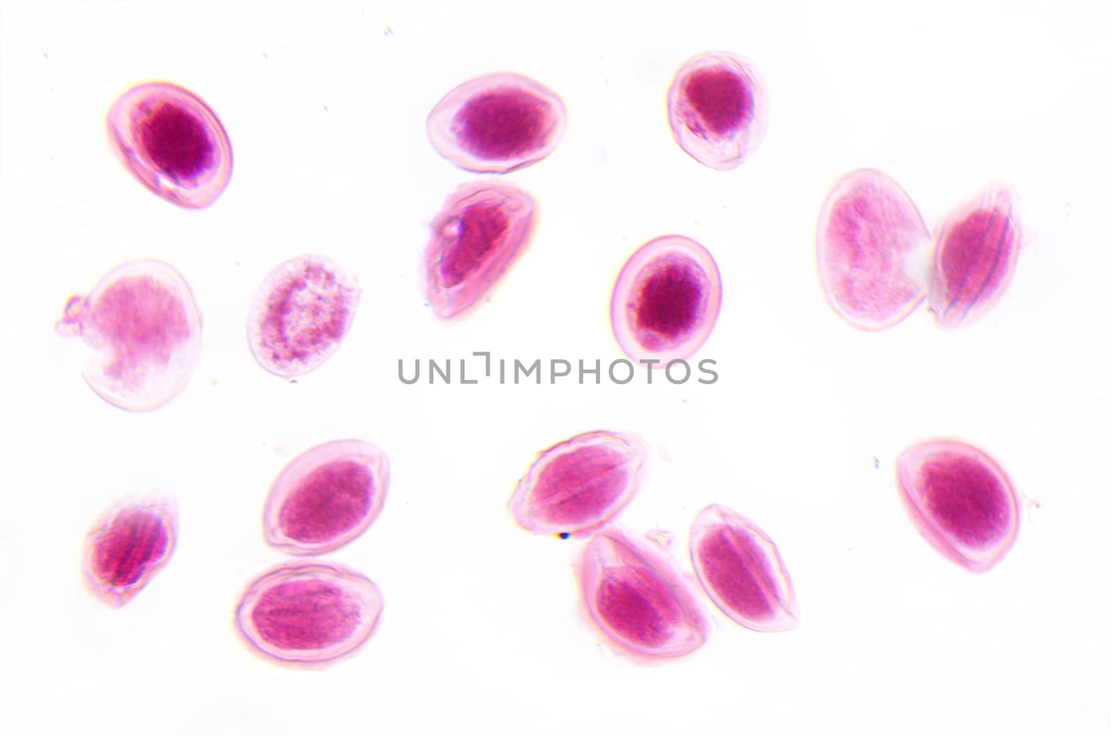 Microscope photography. Ascaris lumbricoides eggs. by HERRAEZ