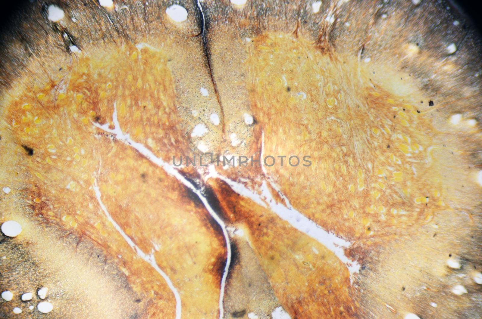 Microscope photography. Spinal cord, cross section. by HERRAEZ