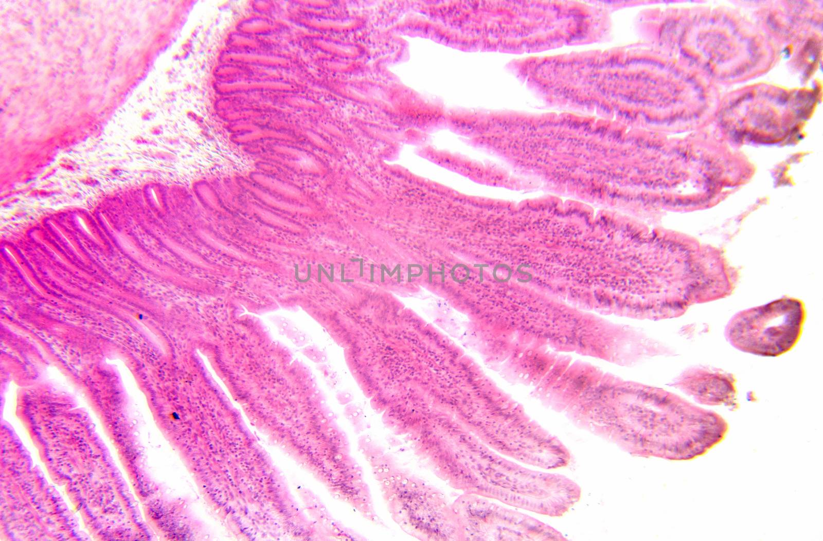 Microscopy photography. Small intestine transversal section. by HERRAEZ