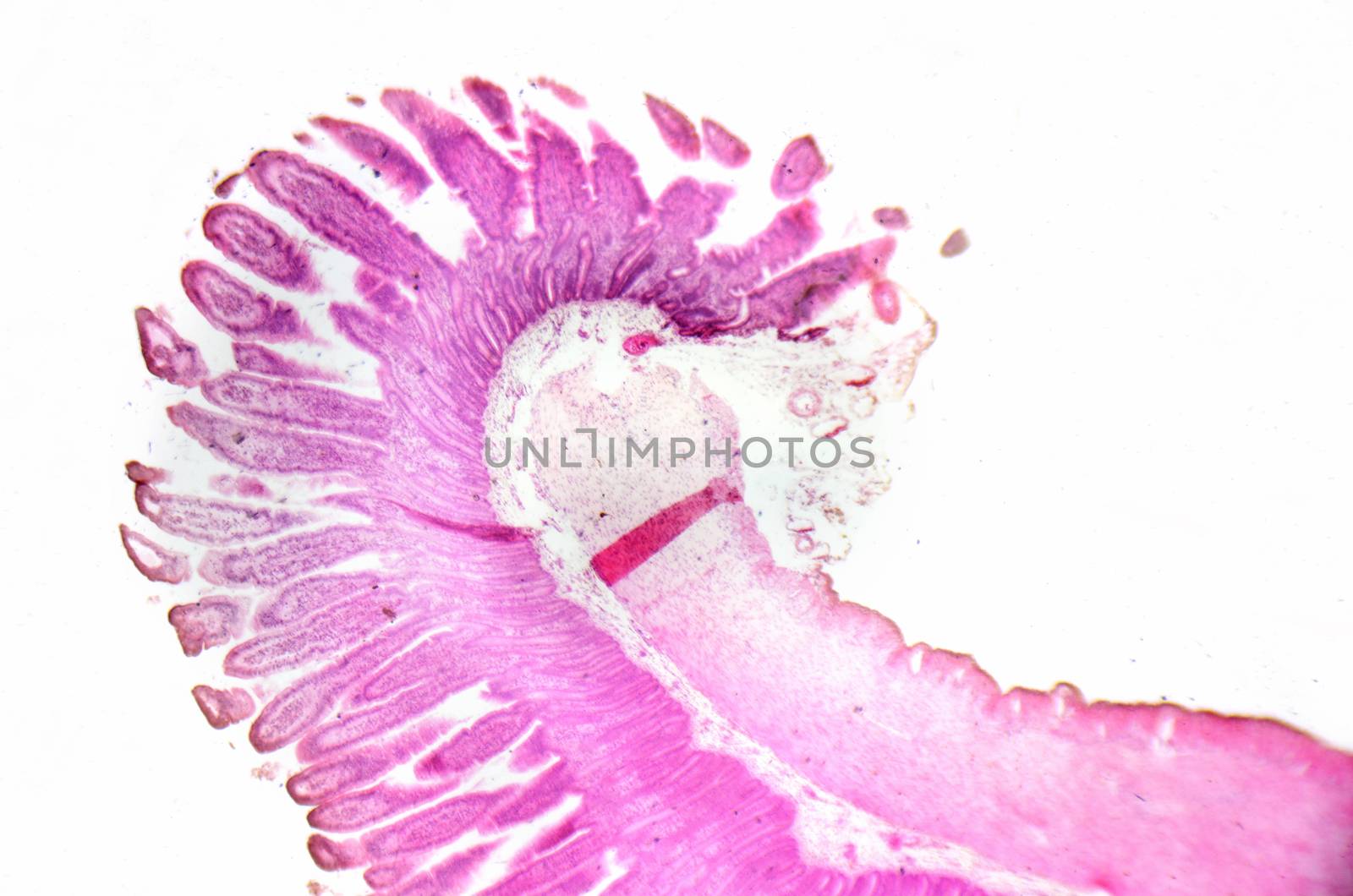 Microscopy photography. Small intestine transversal section.