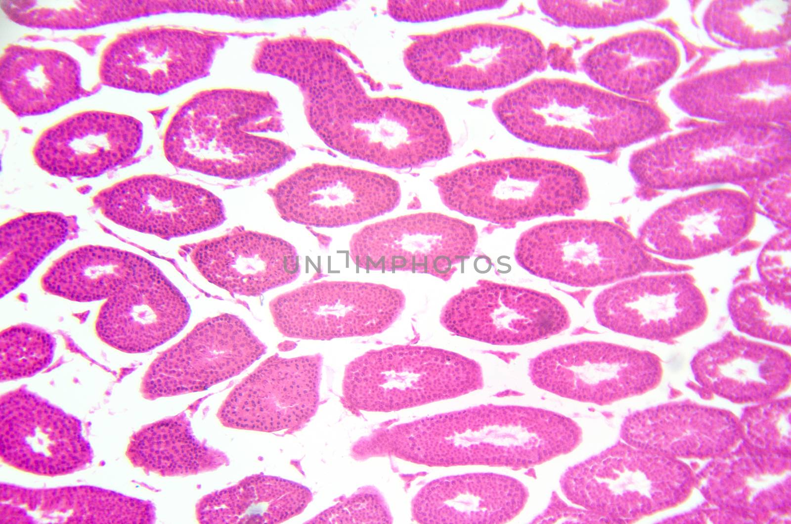 Microscopy photography. Testis, seminiferous tubules, cross section.