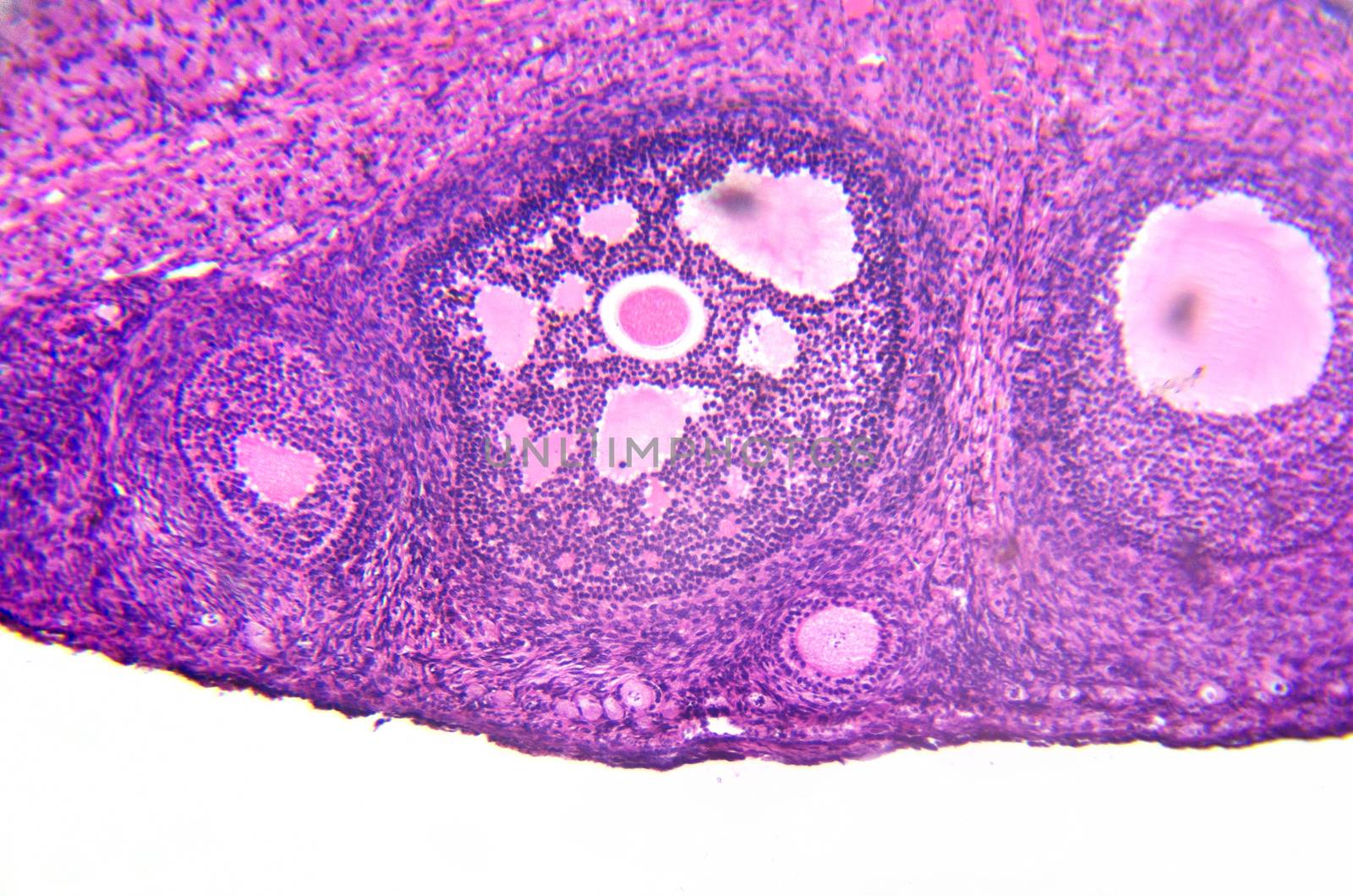 micrograph of ovary showing primordial, primary and secondary follicles isolated on white background.