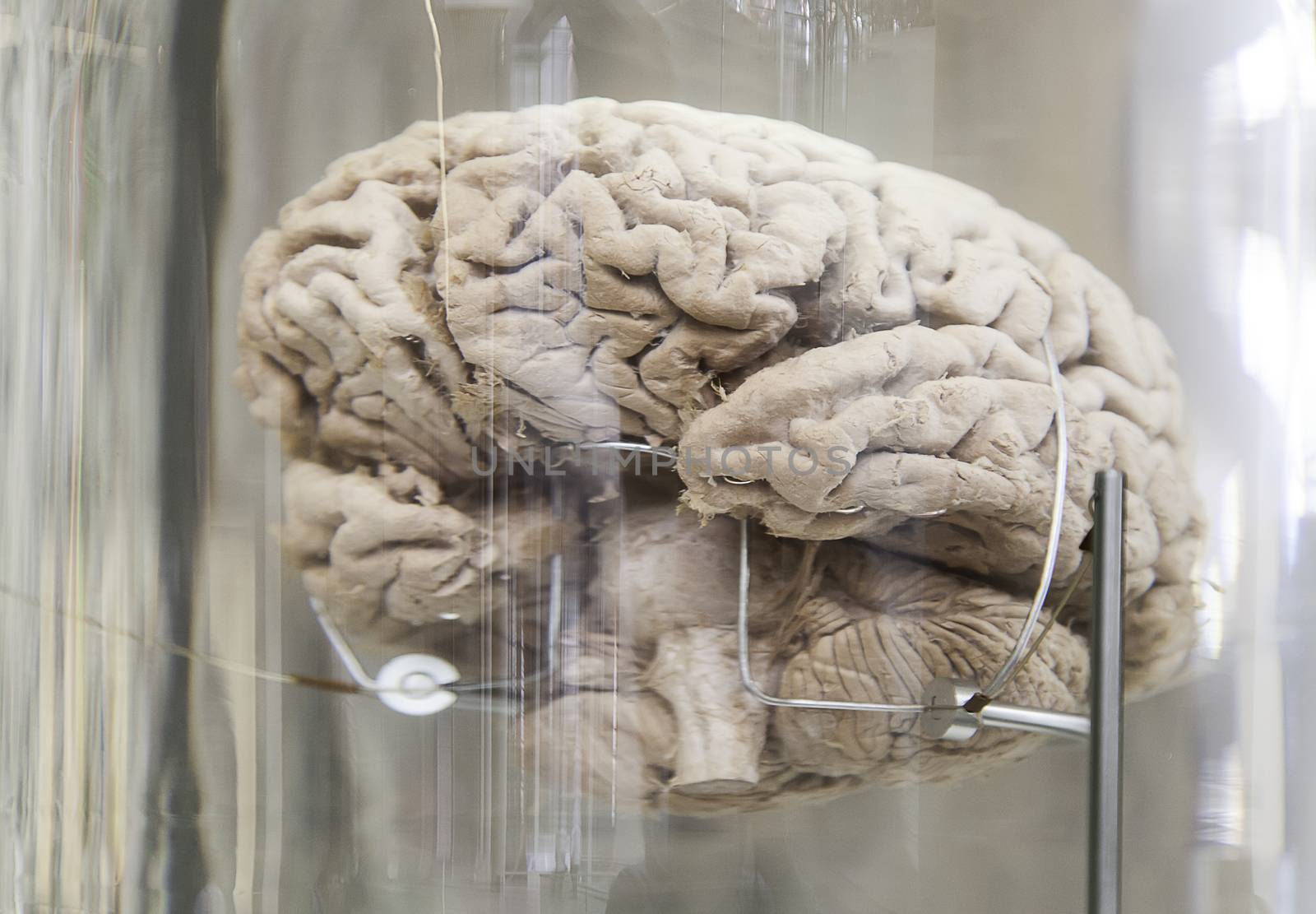 Human brain, detail of a human organ, intelligence and thought