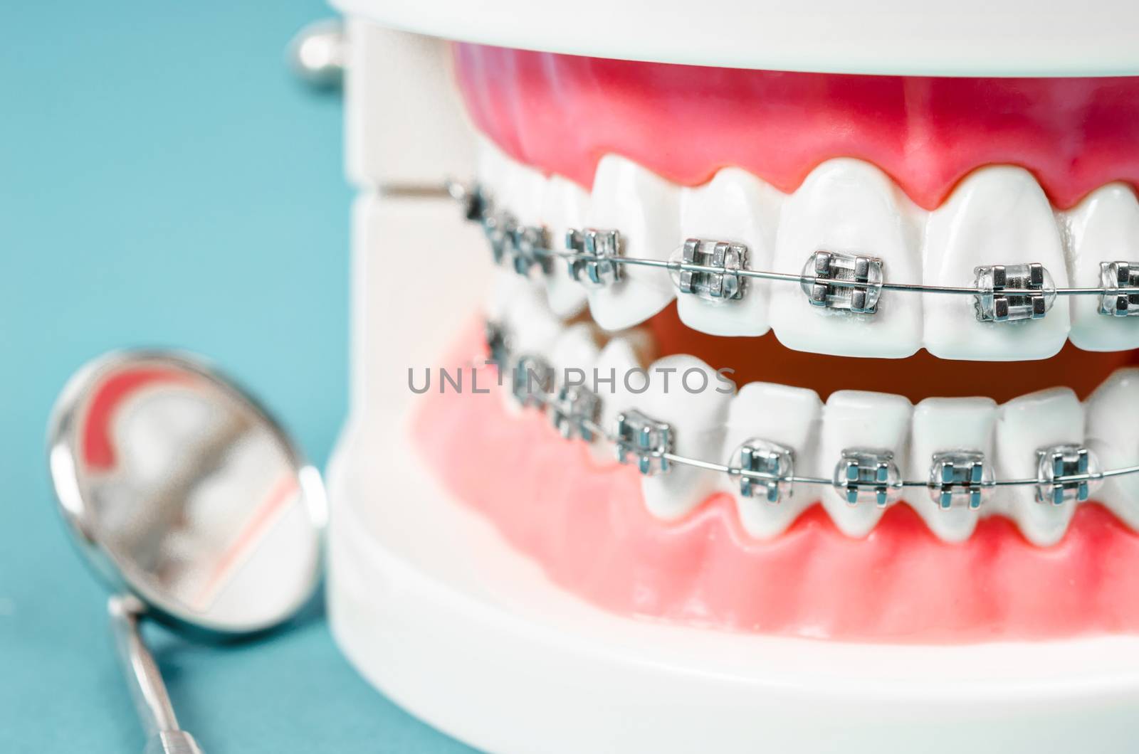 tooth model with metal wire dental braces and mirror dental equipment on blue background.