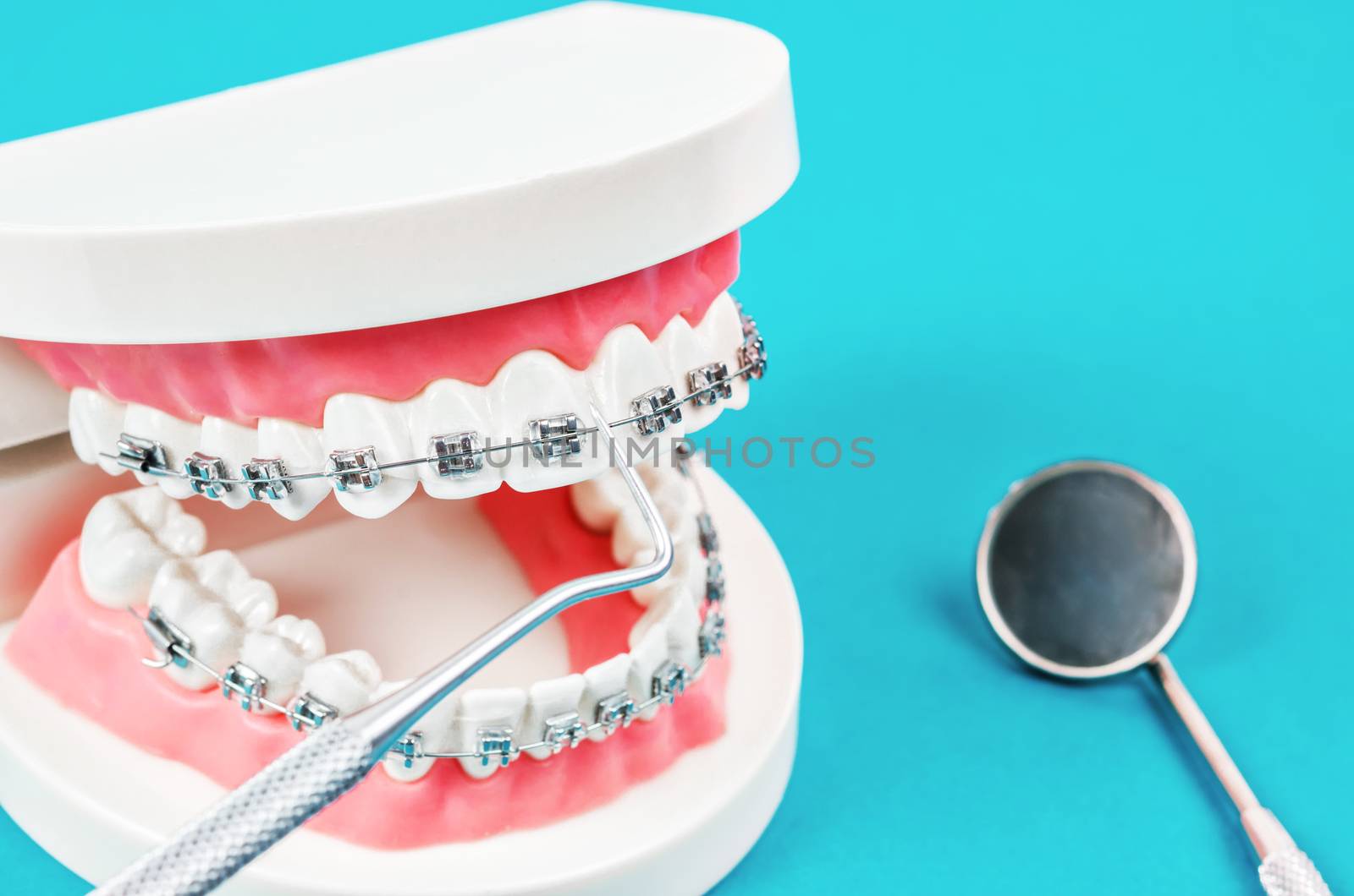 tooth model with metal wire dental braces. by Gamjai