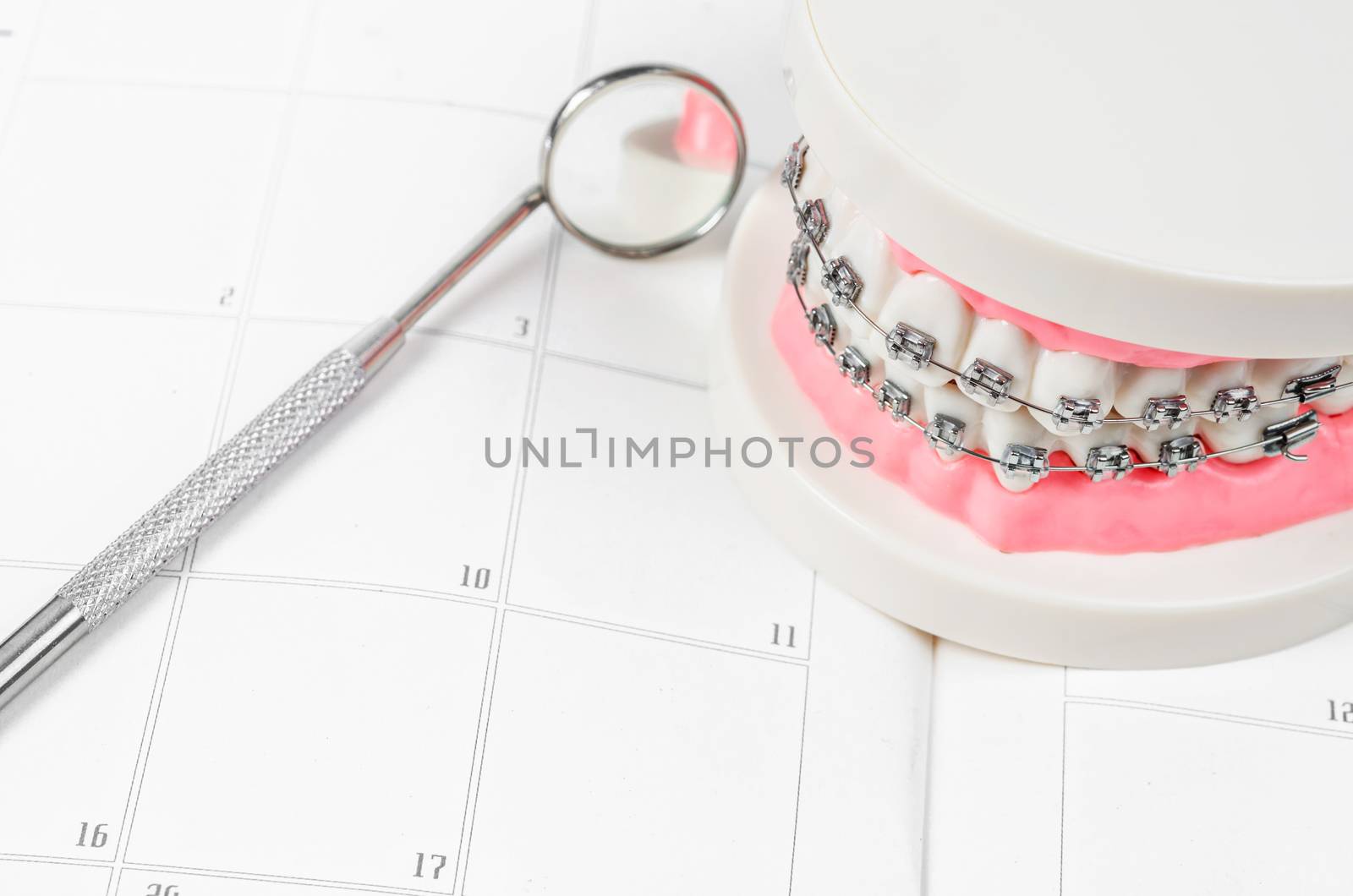 Tooth model with metal wire dental braces on a calendar. Regular checkups are essential to oral health
