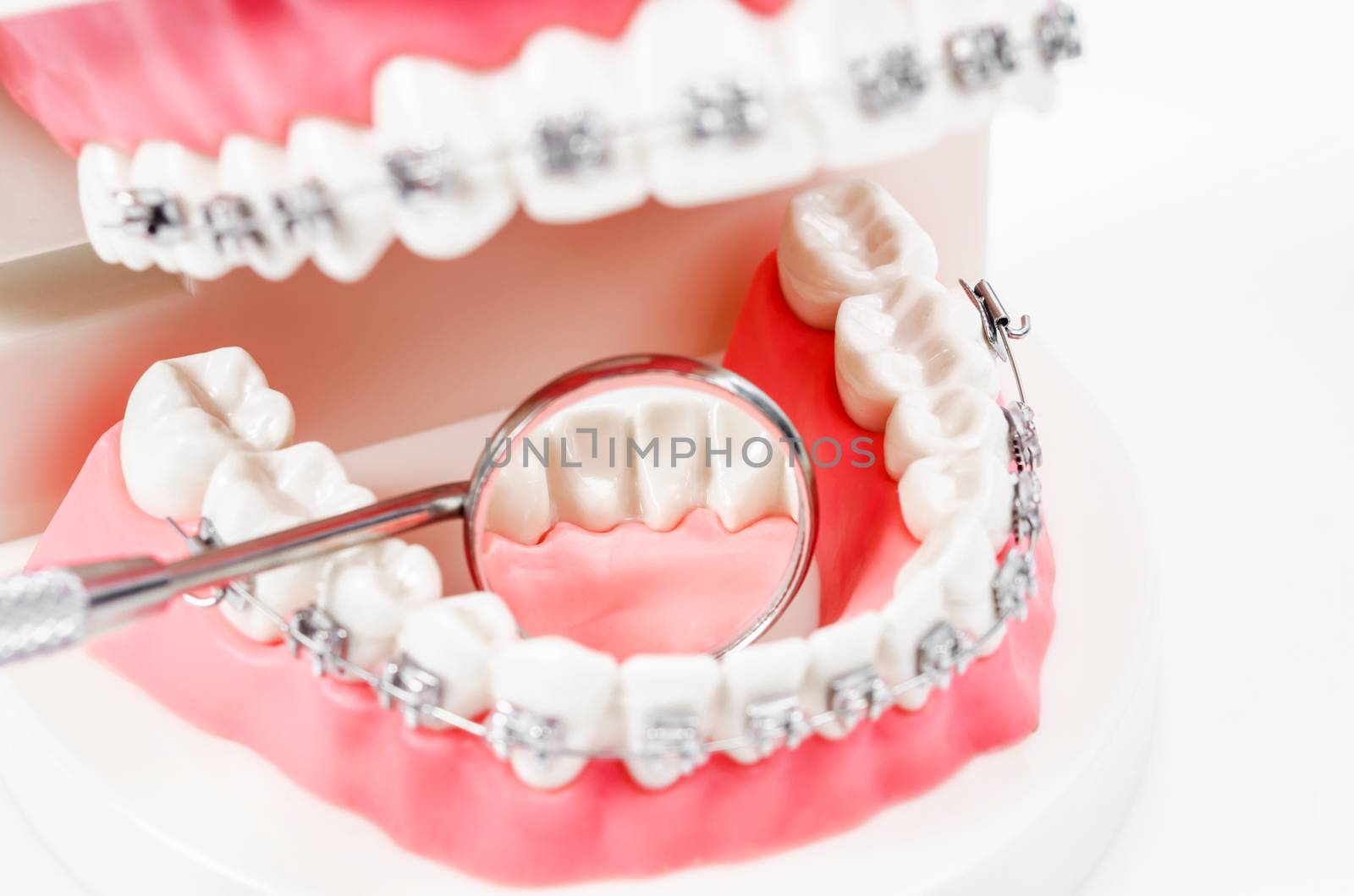tooth model with metal wire dental braces and mirror dental equi by Gamjai