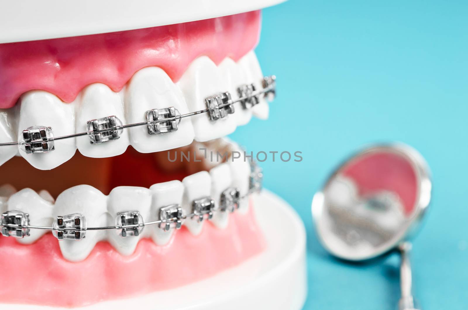 Close up tooth model with metal wire dental braces and mirror dental equipment on blue background.
