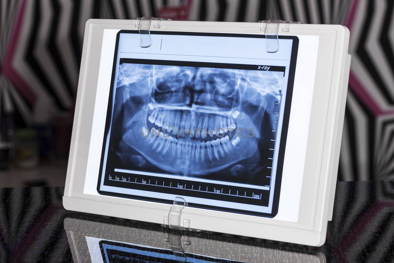 Dental Panoramic x-ray in Viewer with Reflectin