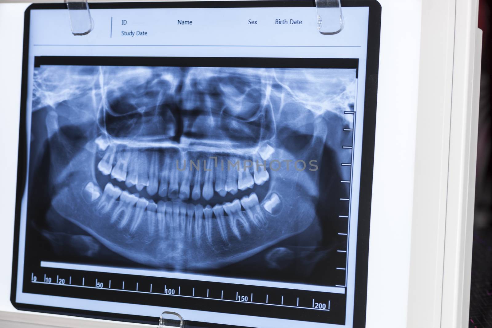 Dental panoramic x-ray in viewer