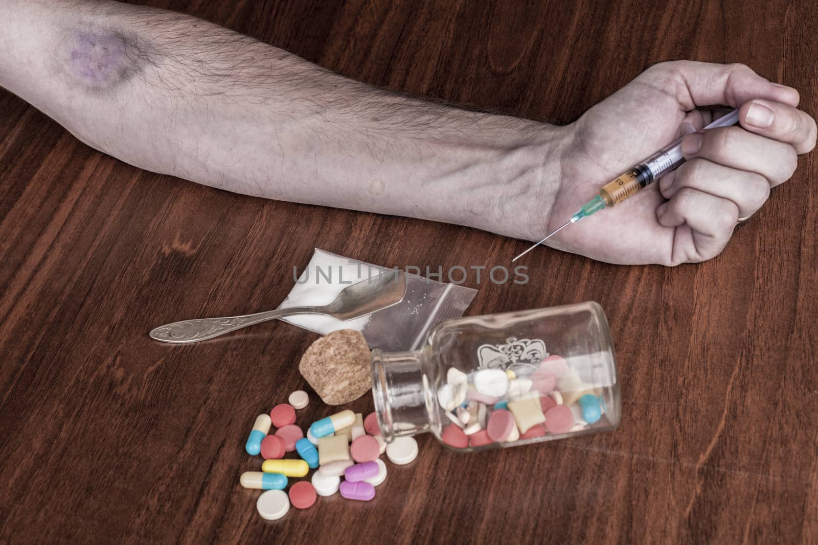 Bruised hand with needle and pills on the table
