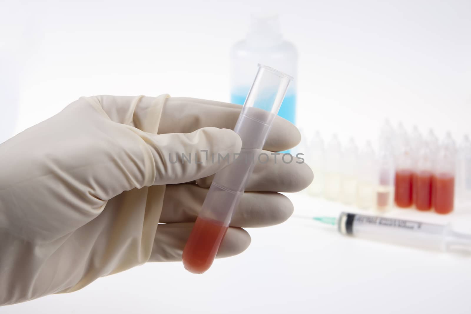 hand with latex glofes examining blood sample in a plastic tube 