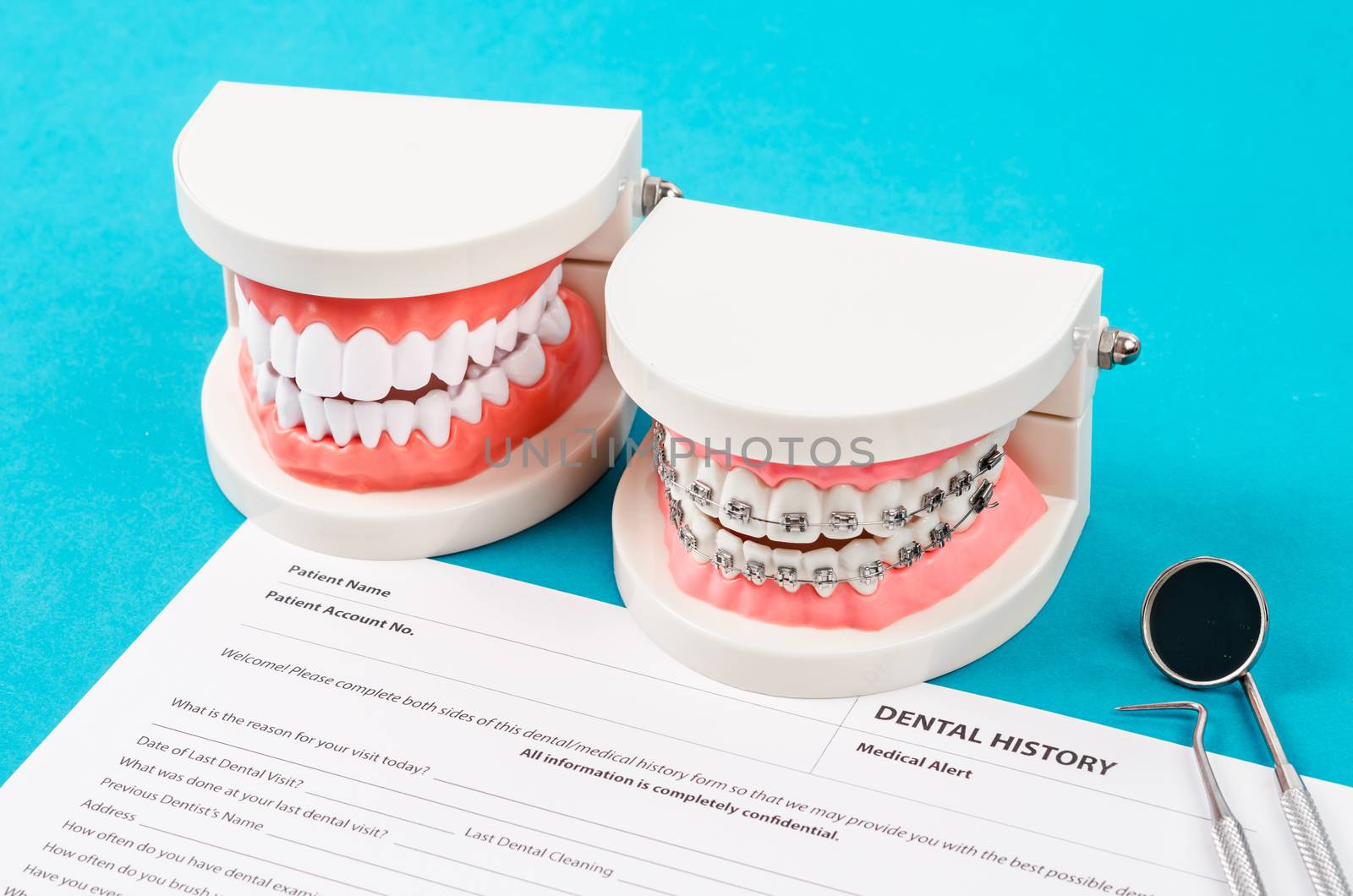 Dental history form with model tooth and dental instruments. Dental health and teeth care concept.
