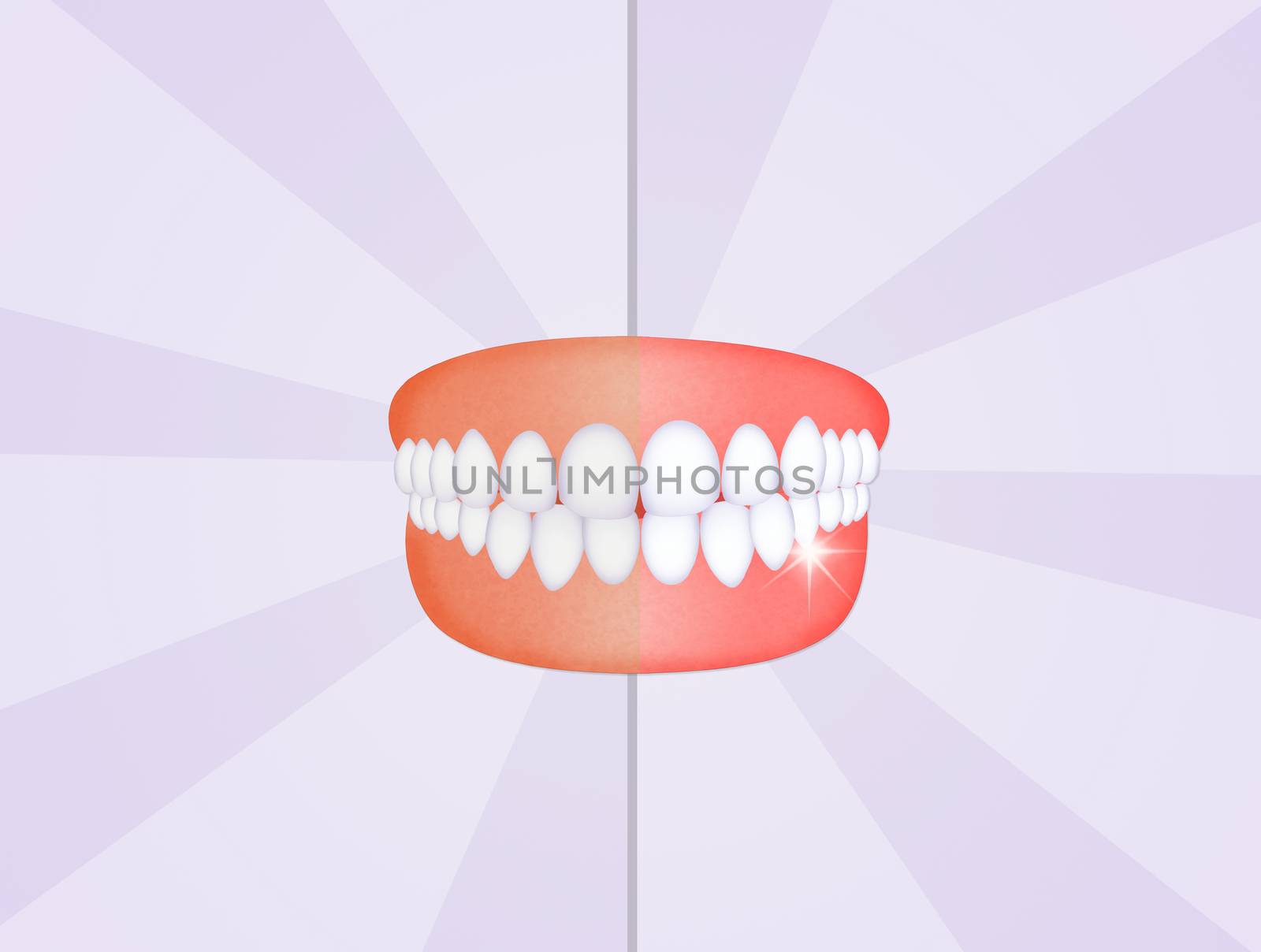 mouth with clean teeth by adrenalina