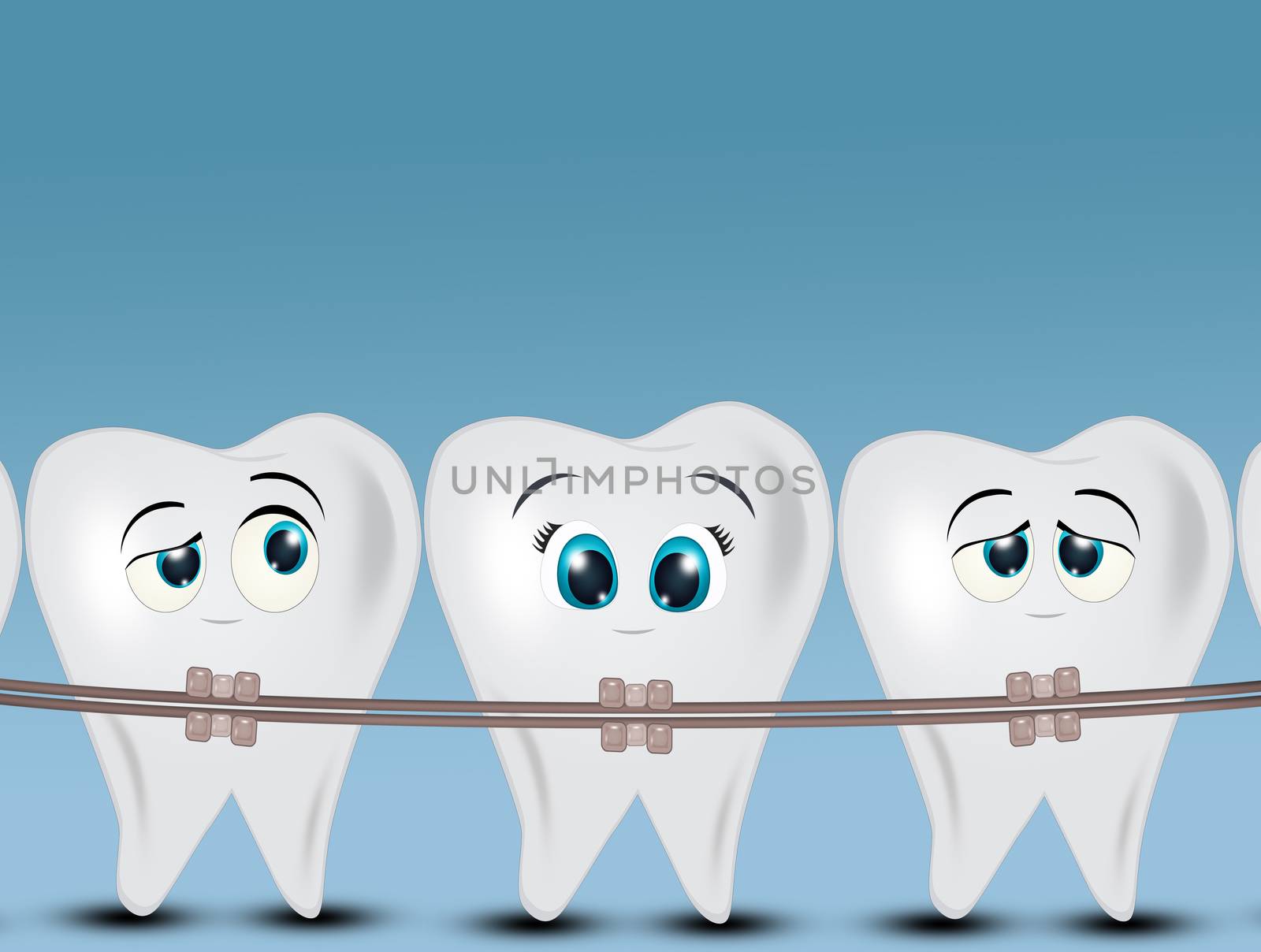 illustration of dental braces