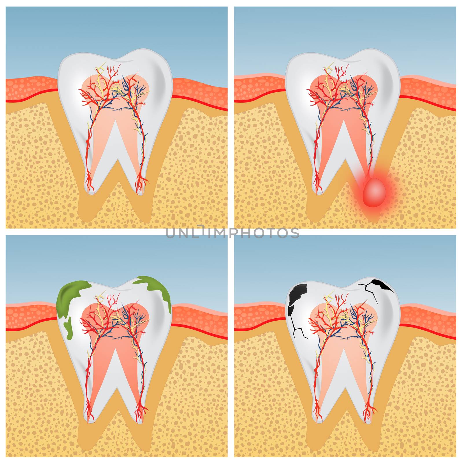 illustration of tooth anatomy by adrenalina