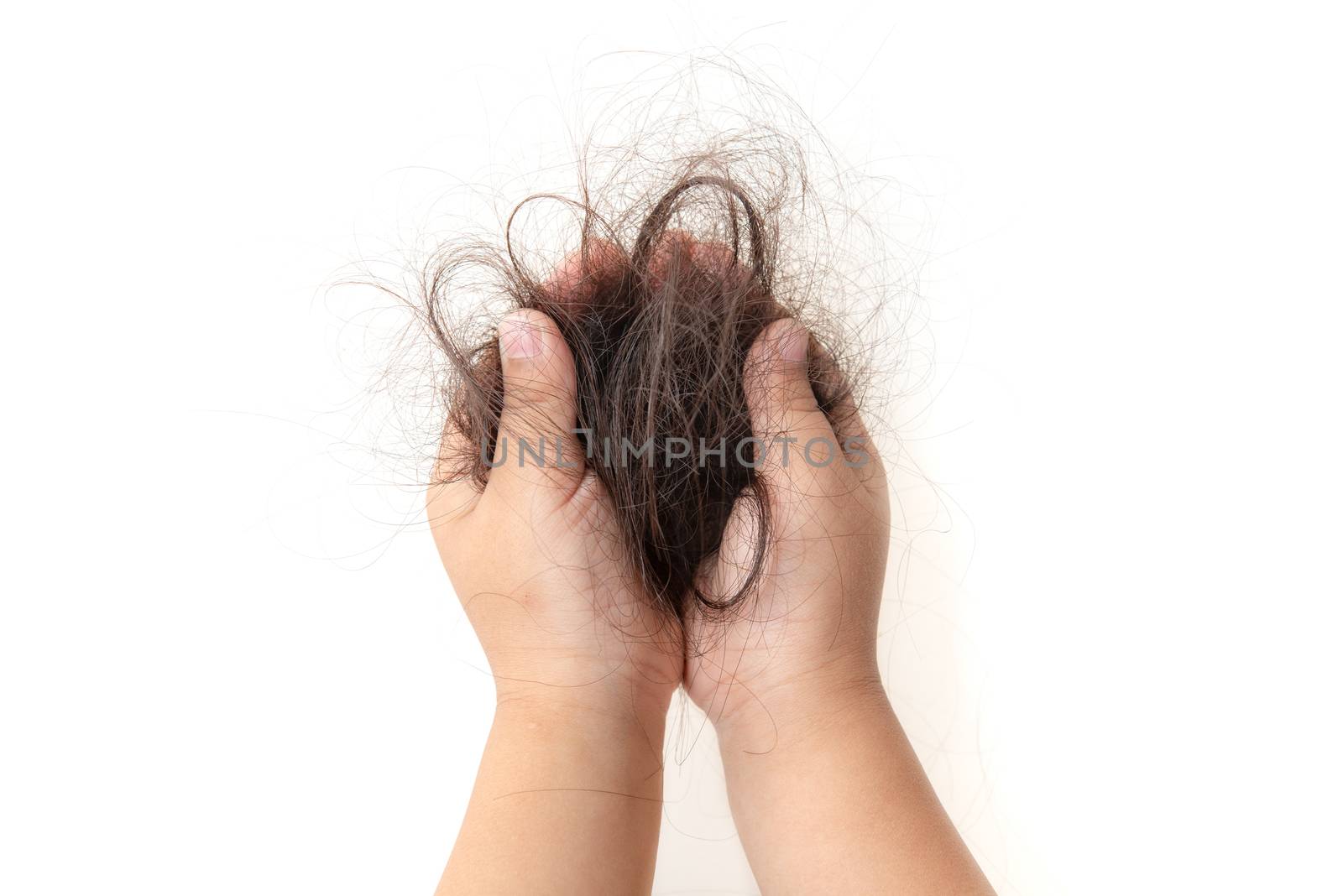 Hair fall in children.  by szefei