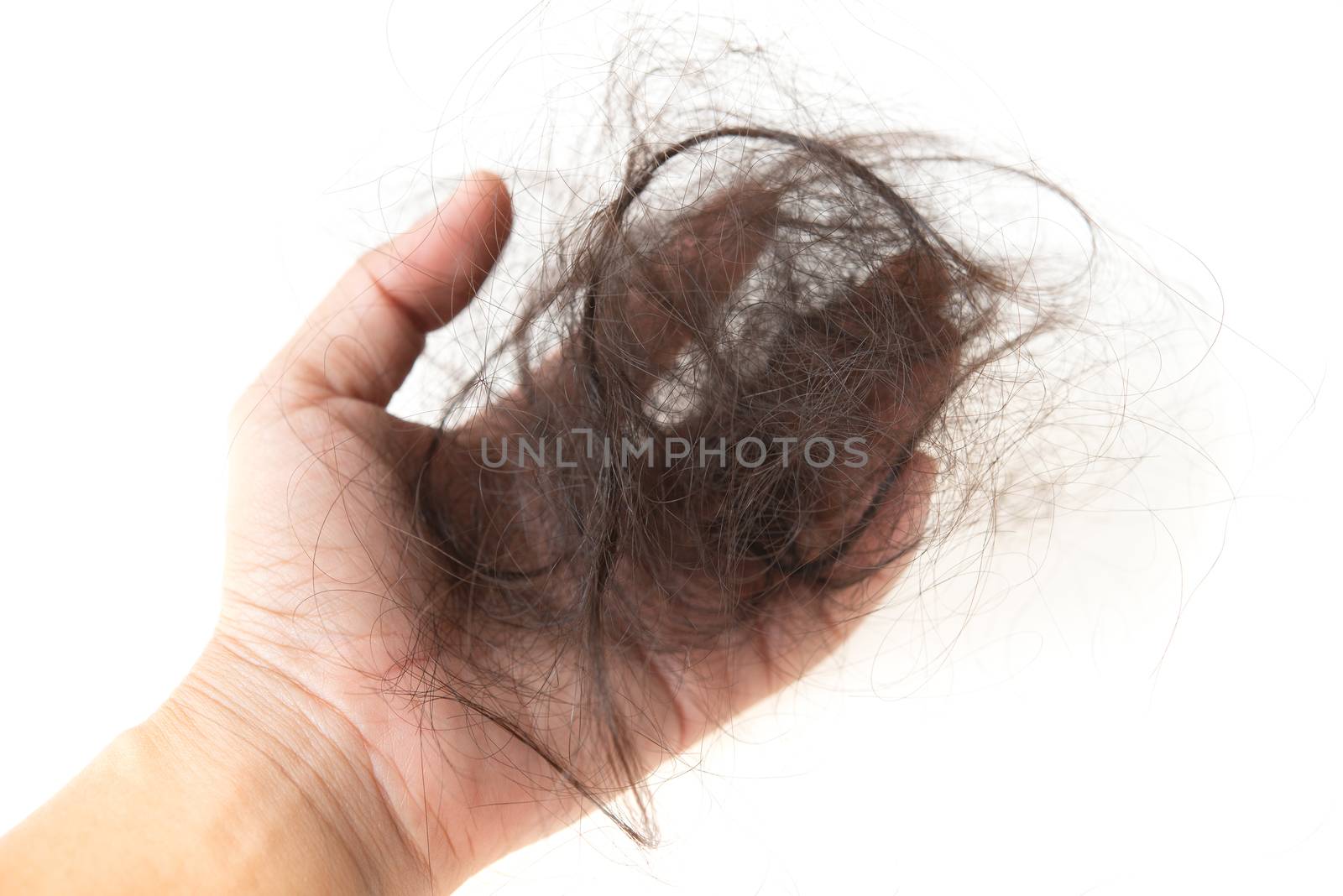 Human hand with lost hair on it, isolated on white background.